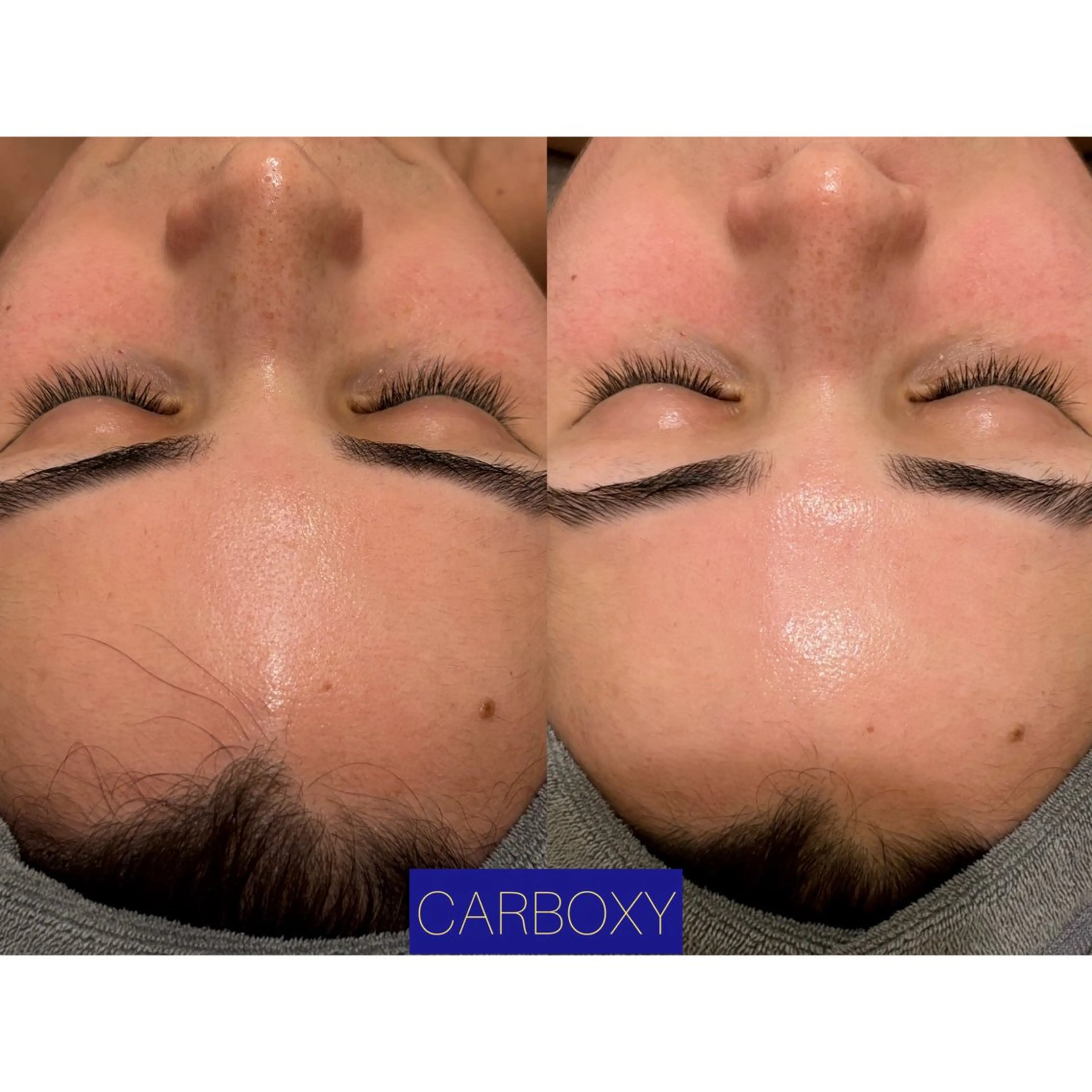 その他 ☆痩身/小顔☆ コルギのエステ・リラクイメージ