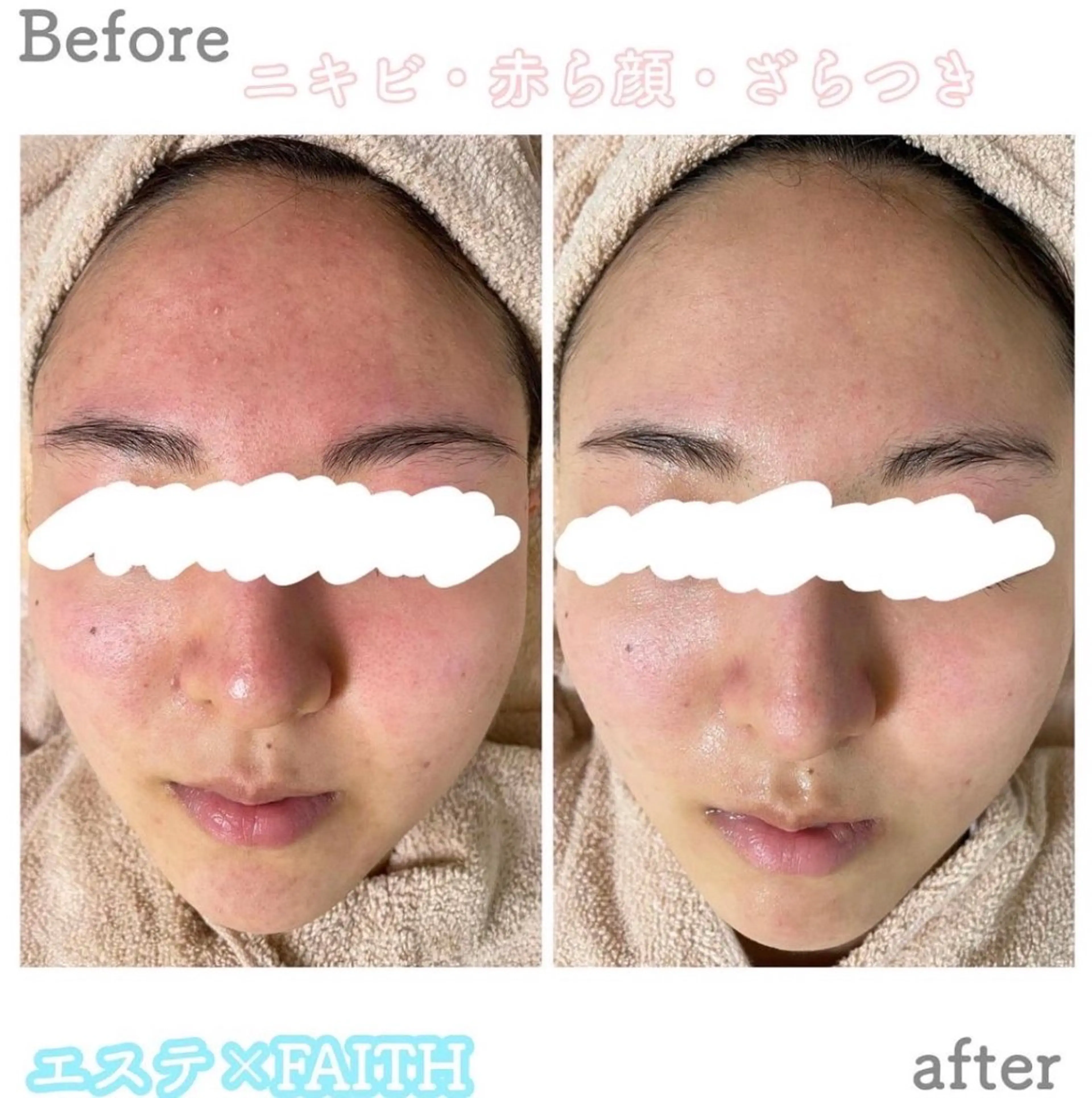 都度払い肌改善専門店 店長二上文香のエステ・リラクイメージ