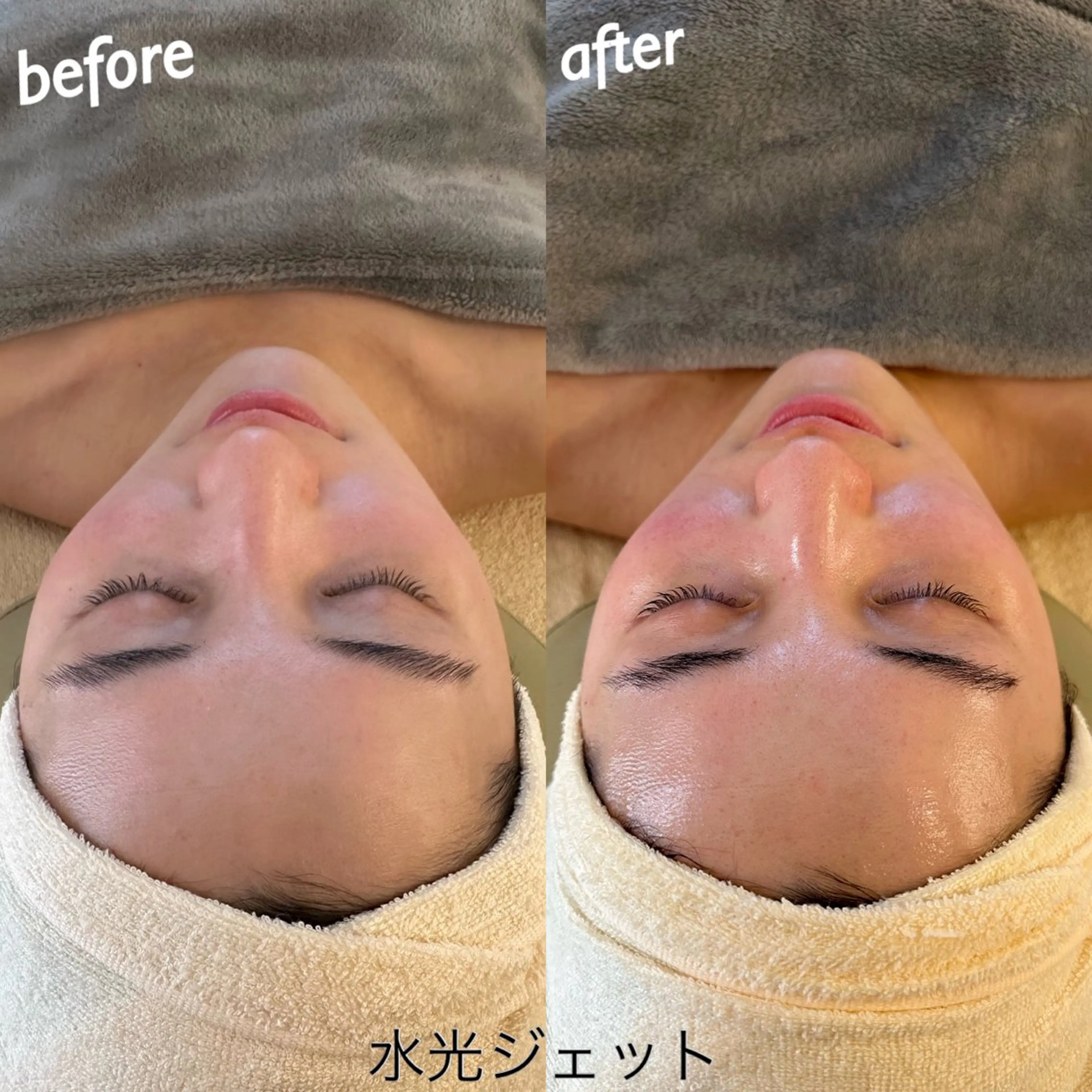 エステ リラク うなじ脱毛/美肌脱毛 LABELのエステ・リラクイメージ