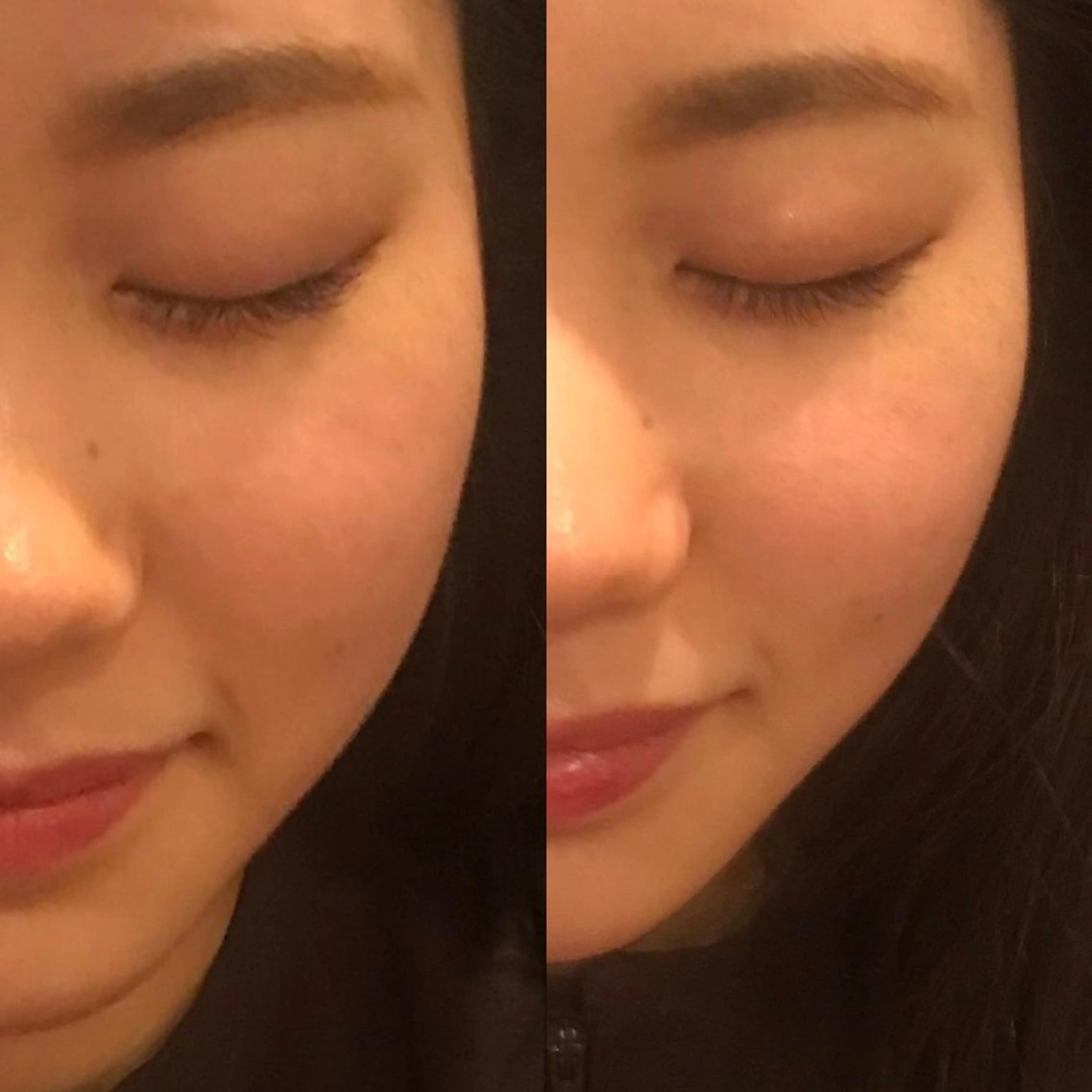 エステ リラク 小顔美容鍼灸Acubelle Yakuin.【アキュベル薬院】所属・石川 真梨奈  美容鍼灸/アロマのエステ・リラクイメージ