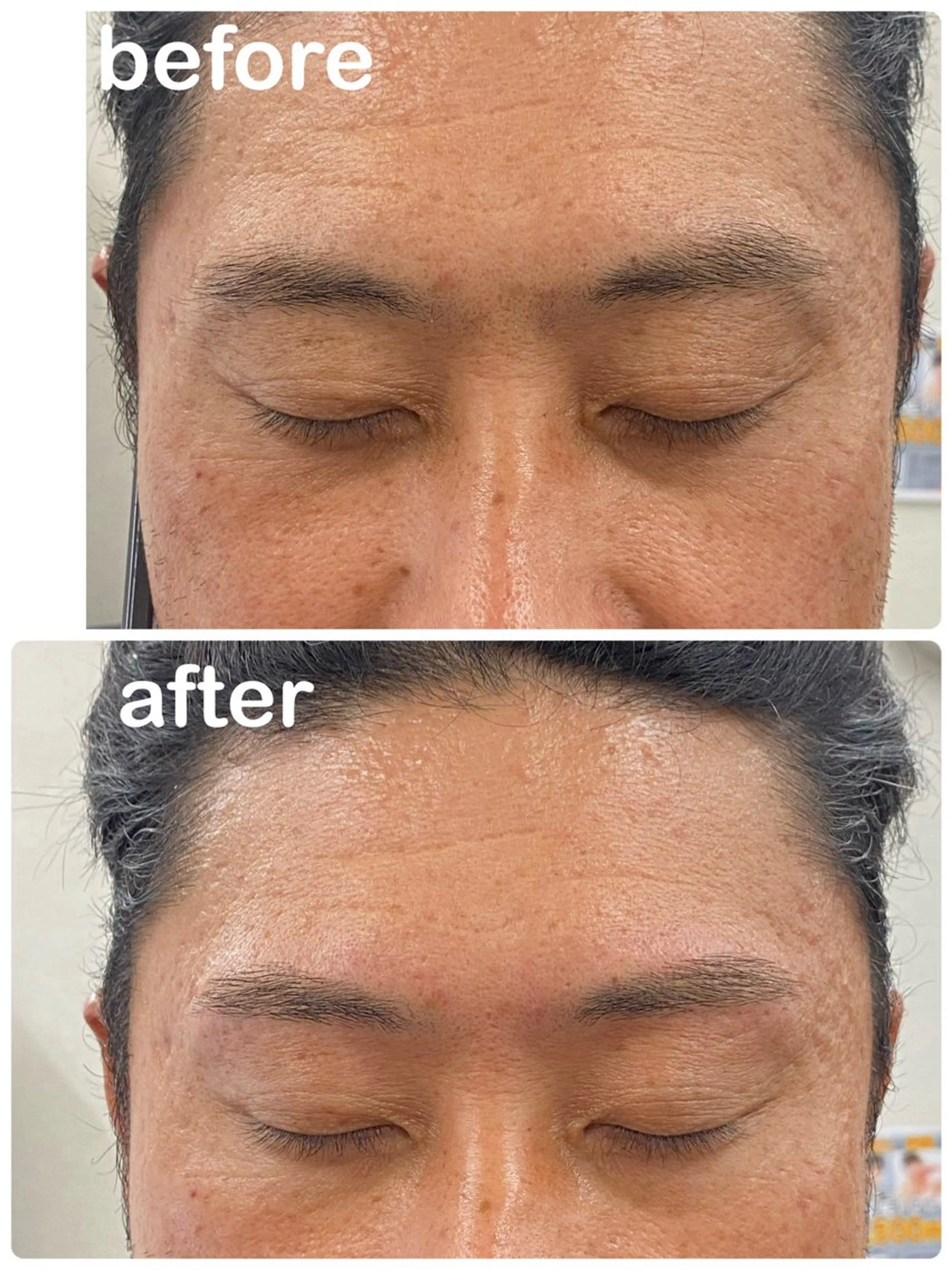 メンズ アイブロウ Mubye所属・Yamagtchi hinaのエステ・リラクイメージ