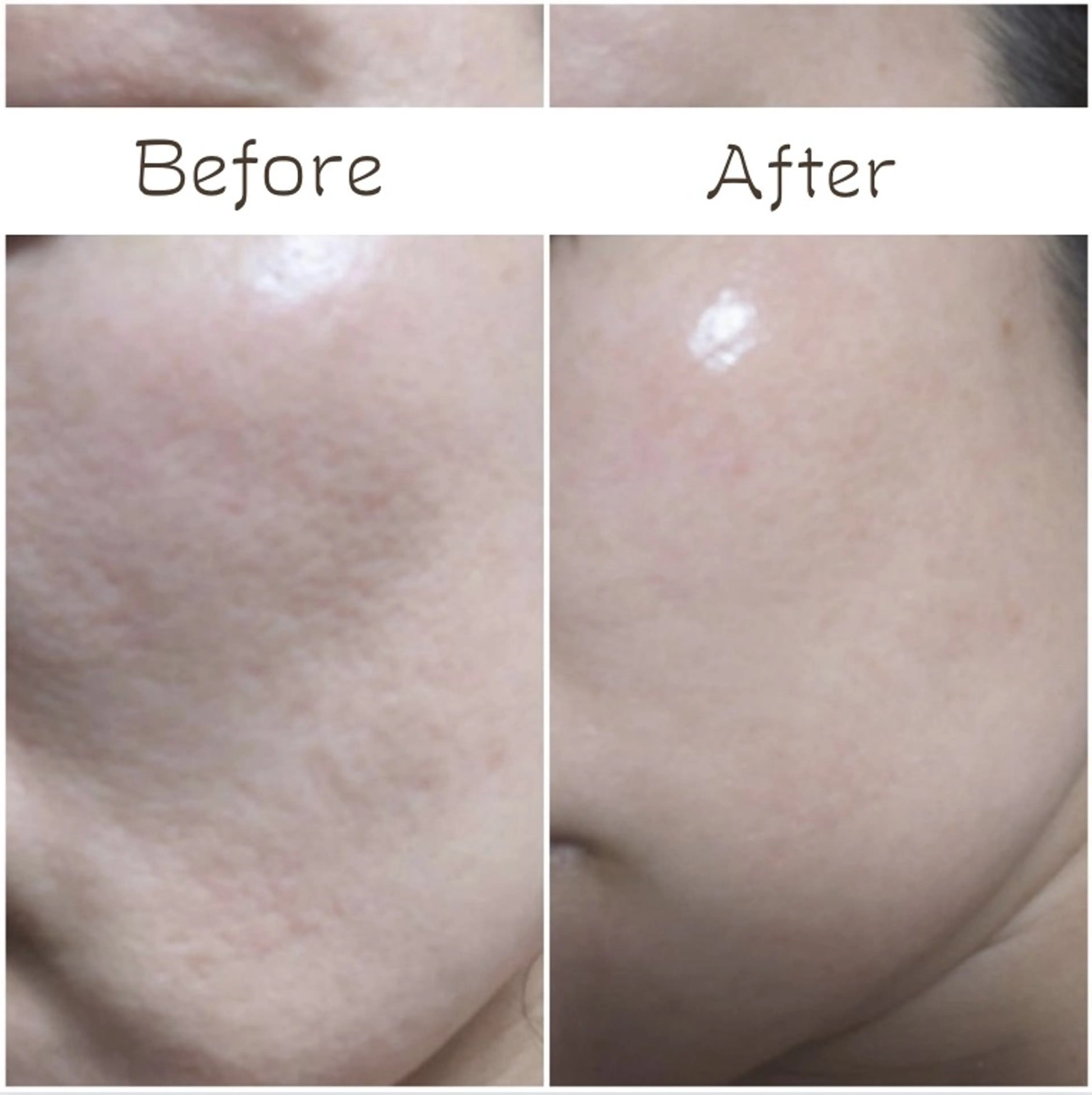 フェイシャル/毛穴 /シミ/たるみ東灘区のエステ・リラクイメージ