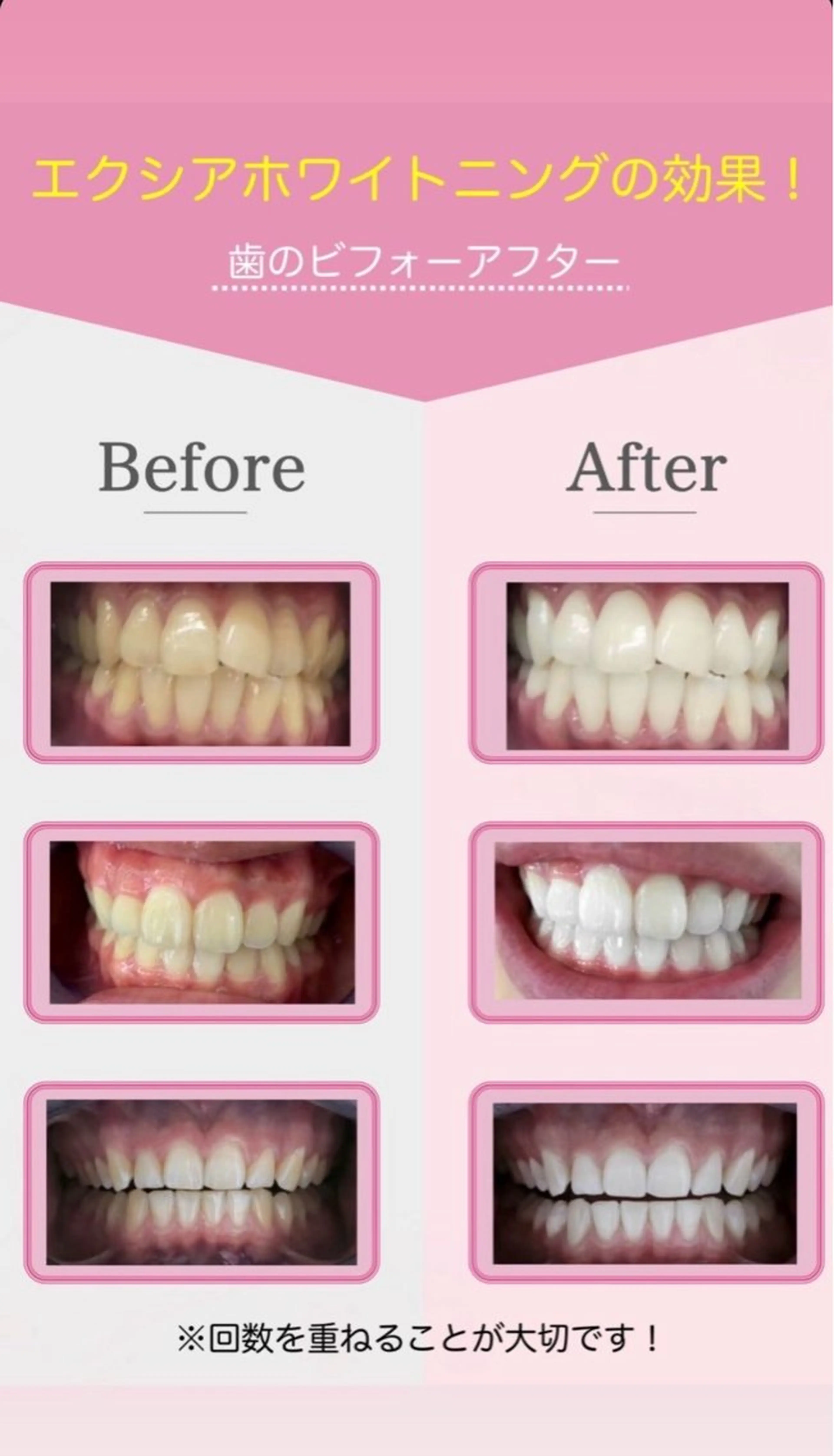 セルフホワイトニングサロン　エクシアホワイト西尾店所属・エクシアホワイト西尾 堀内恵のその他イメージ