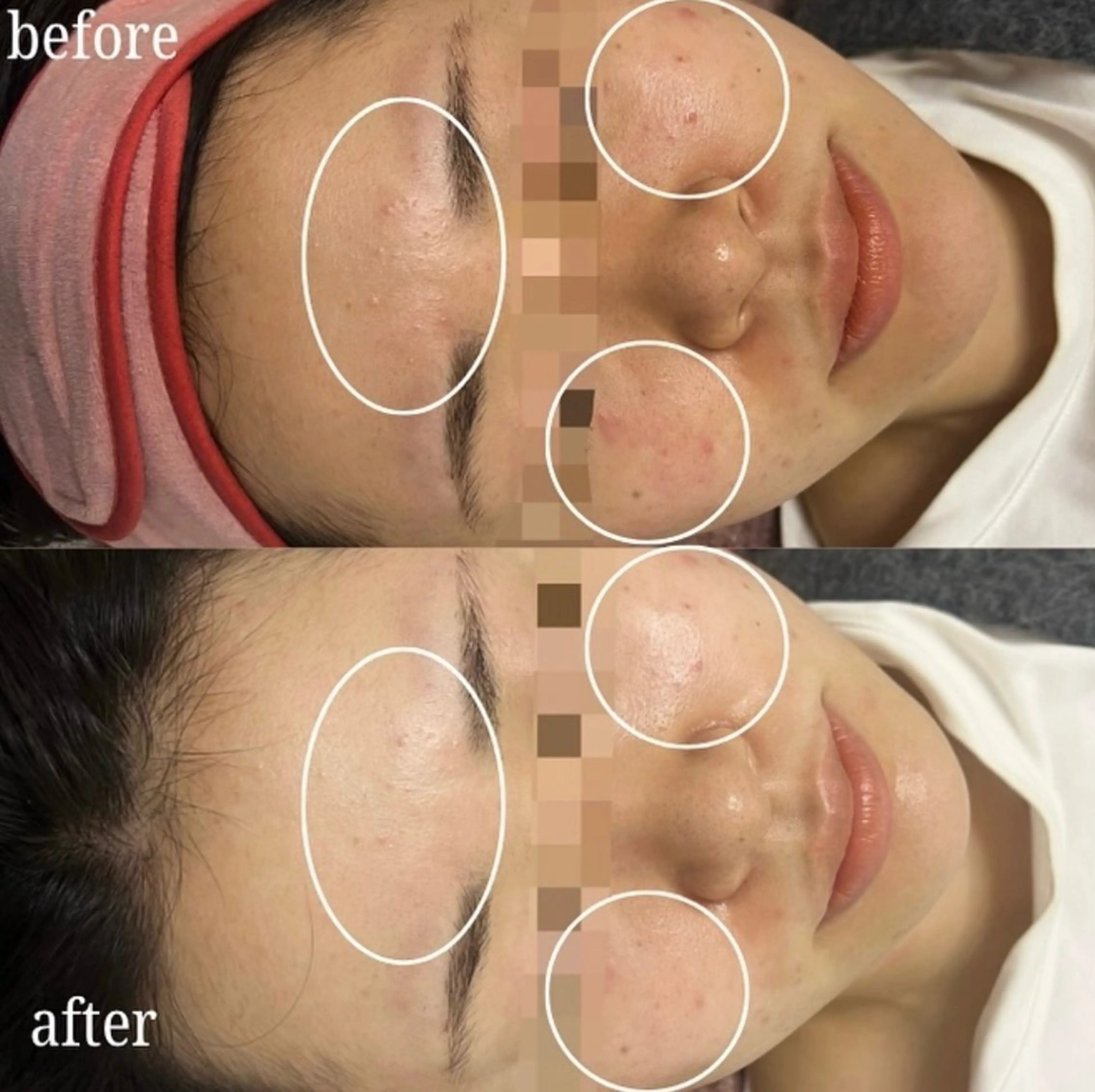 看護師が施術する美容 ナスサロ/川口のエステ・リラクイメージ