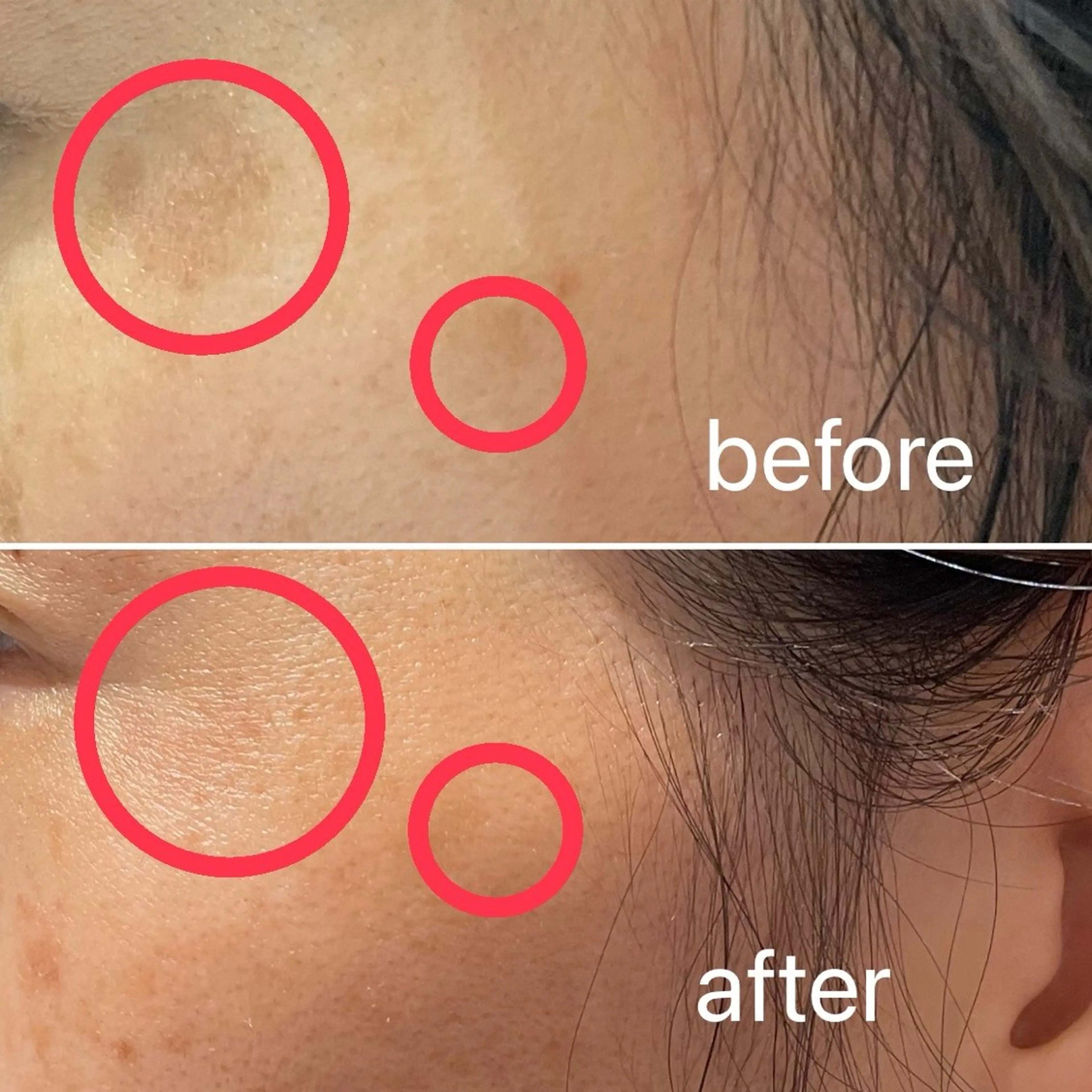 痛くないシミ取り 【荻窪】石橋のヘアスタイル