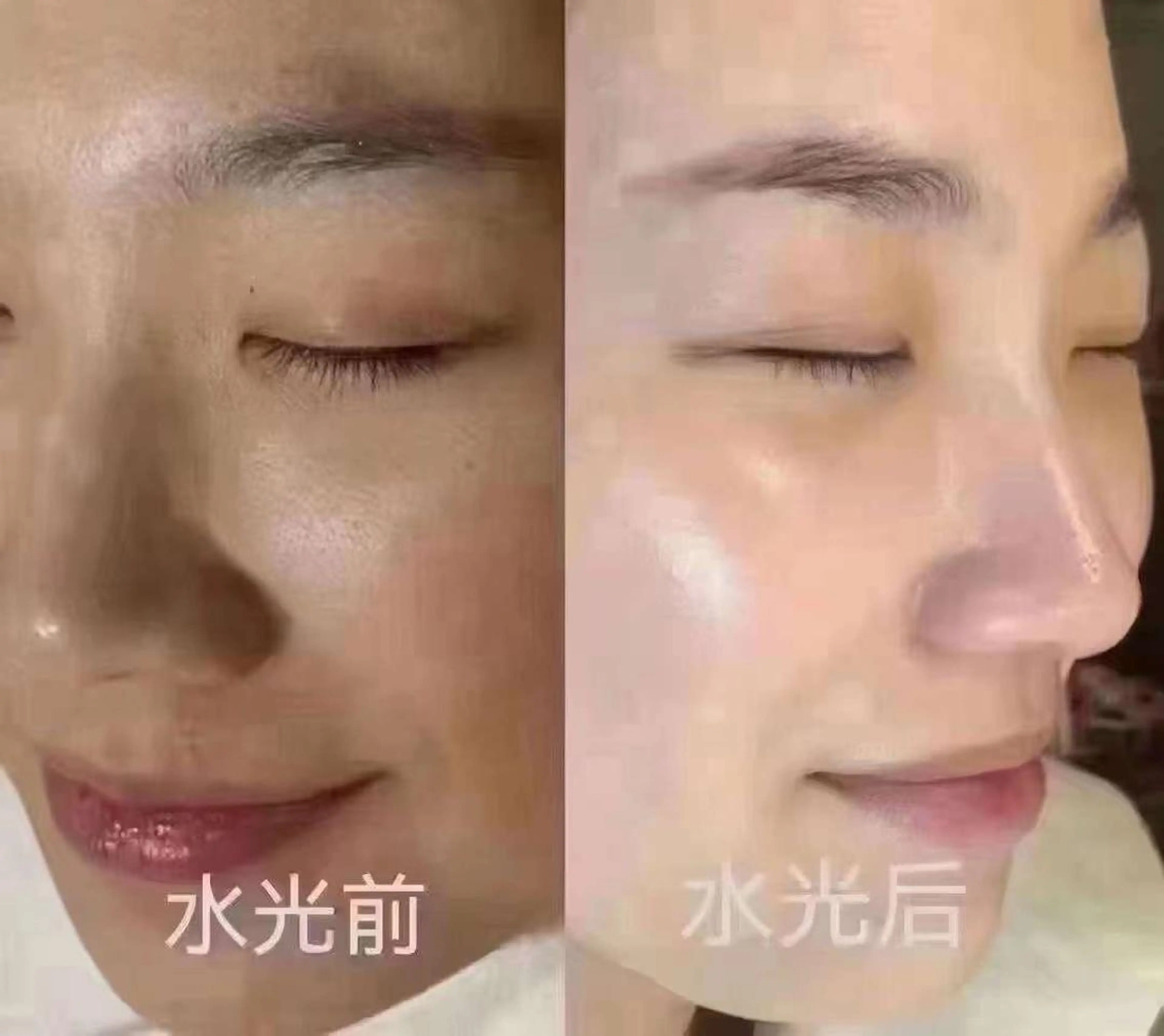 ネイル マツエク・マツパ エステ aliaハイフ&水光ジェットサロン所属・aliaハーブ水光店 エステティシャン募集のエステ・リラクイメージ