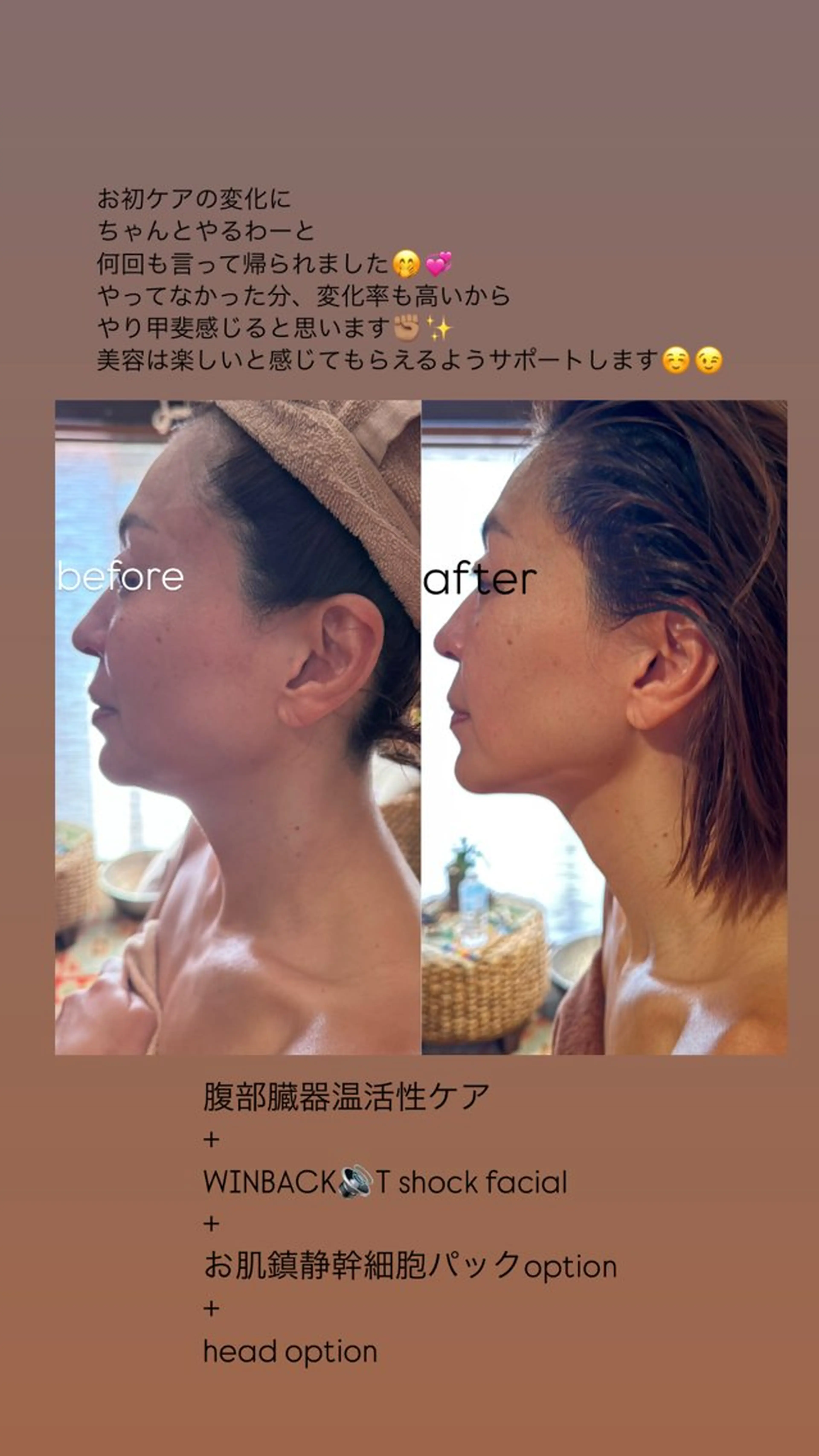 エステ WINBACK salon　un agio所属・サロンドアンアージョ un agioのエステ・リラクイメージ