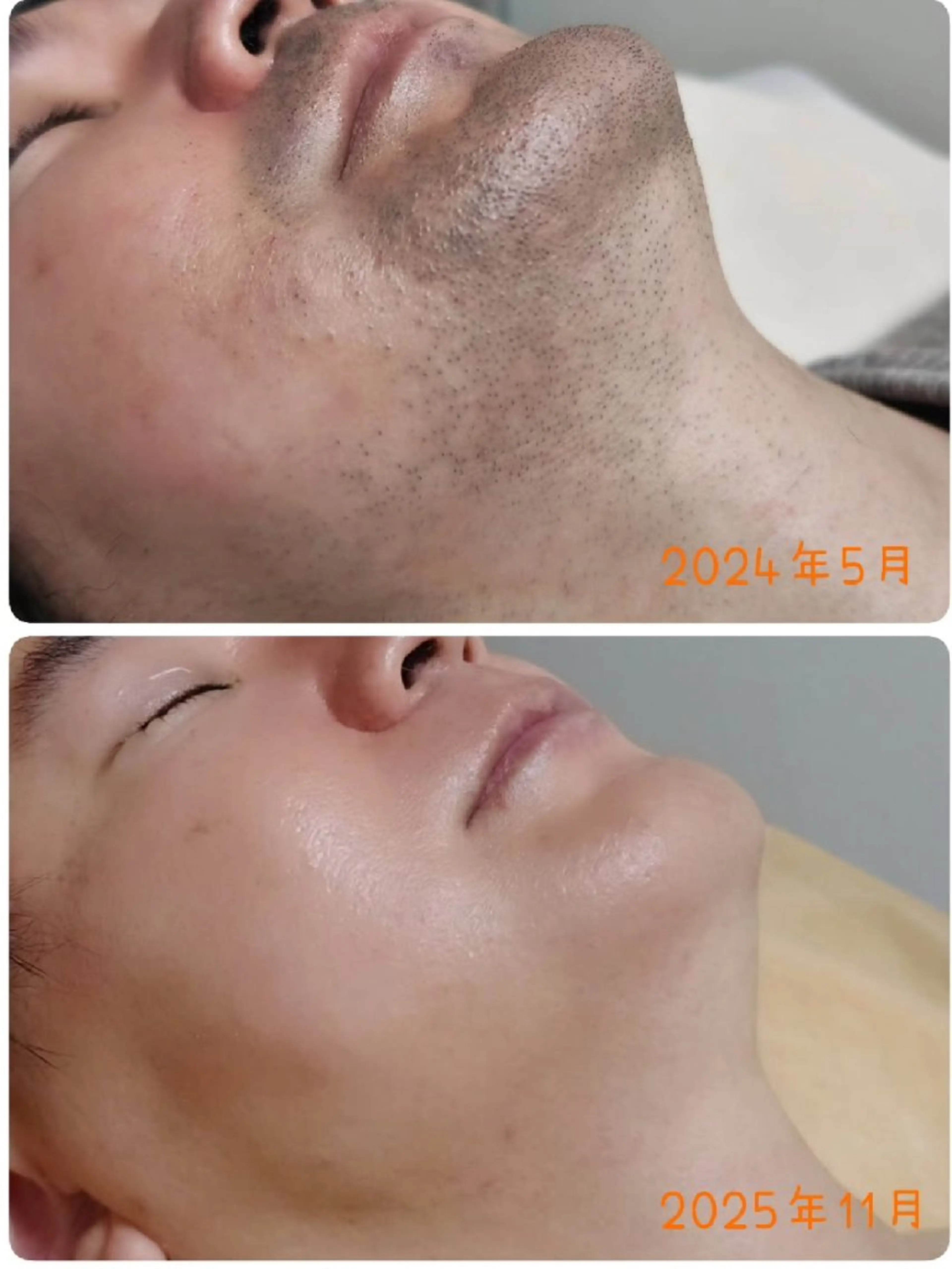 ブラジリアンワックス 脱毛 キナリのエステ・リラクイメージ