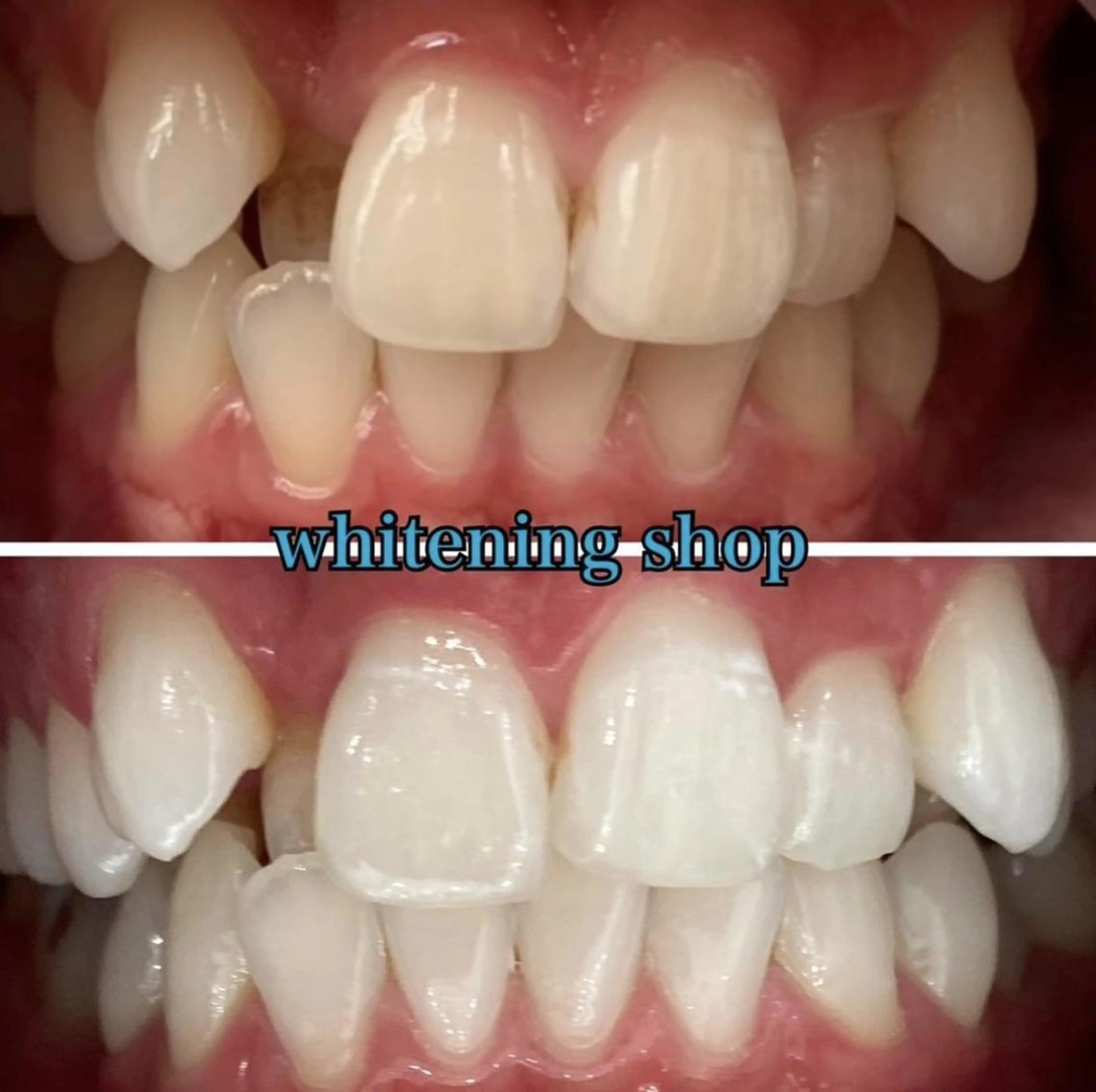 ホワイトニング ショップ千葉店のその他イメージ