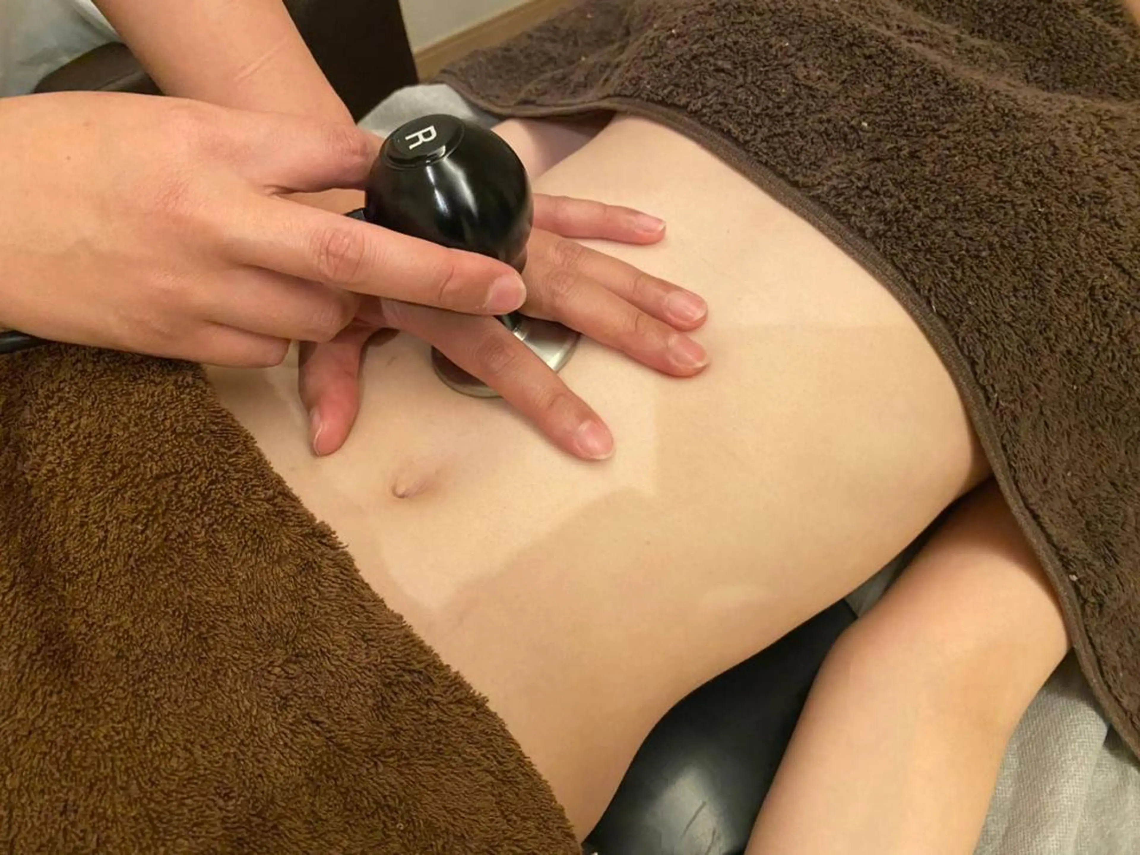 ラジオ波WINBACKウィンバック 30分の写真