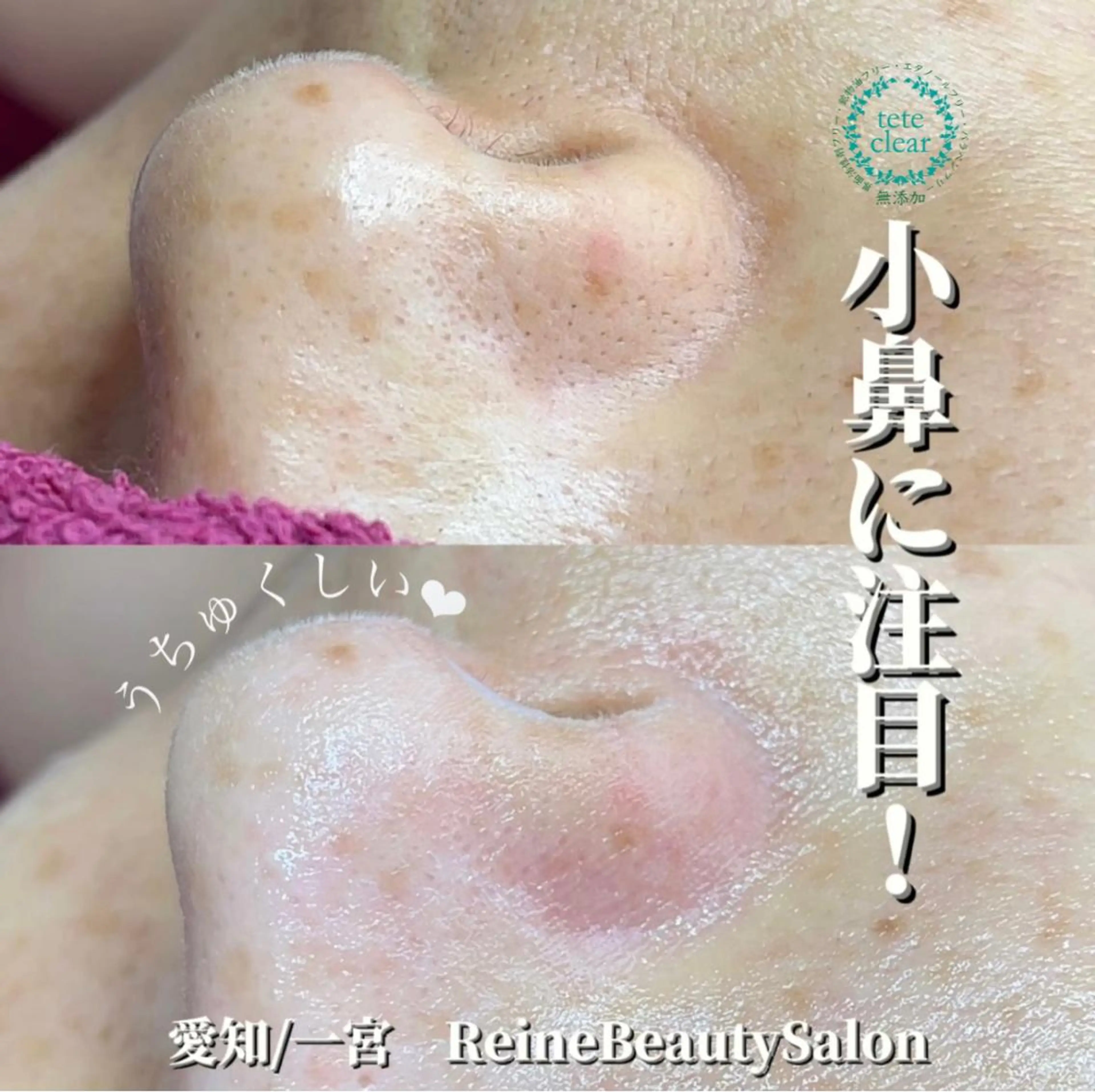 エステ Reine BeautySalon所属・毛穴/シミ肝斑/脱毛 横山梨里のエステ・リラクイメージ