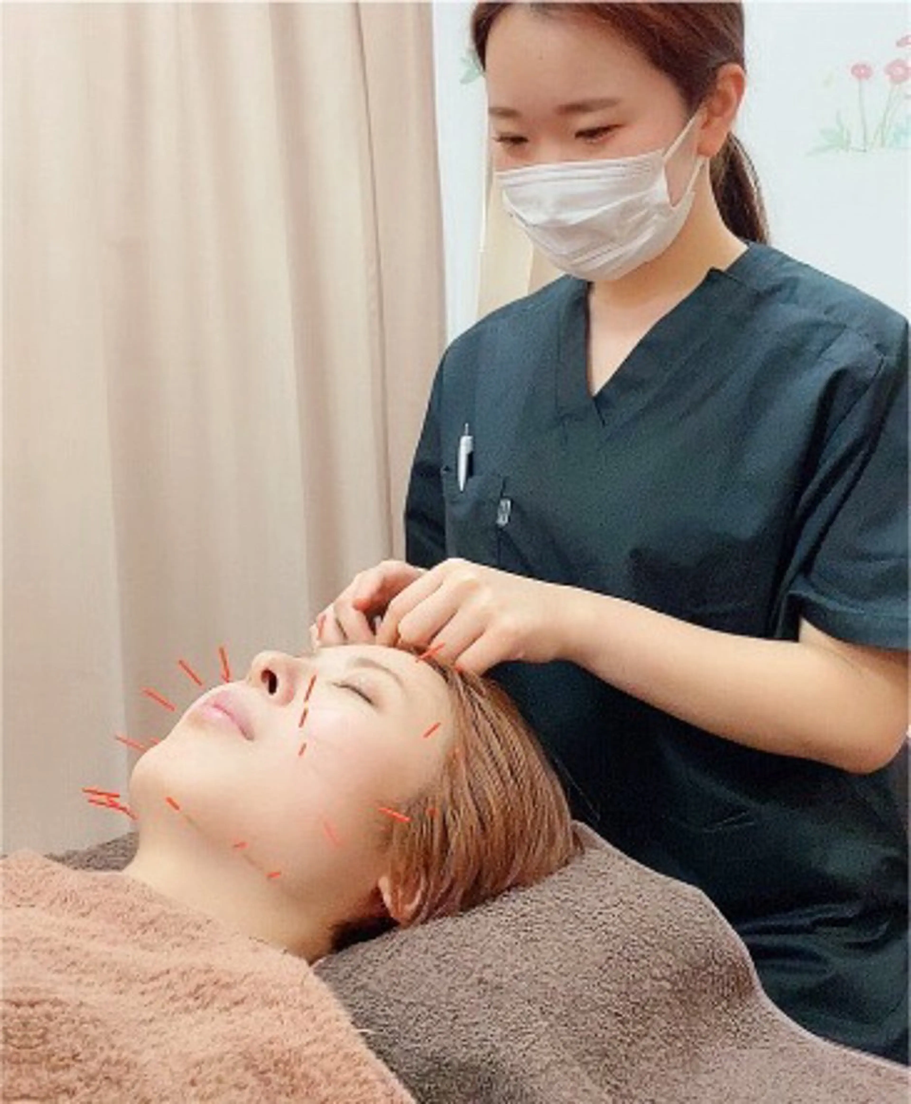 リフトアップ、むくみ改善に劇的効果‼️ 電気美容鍼の写真