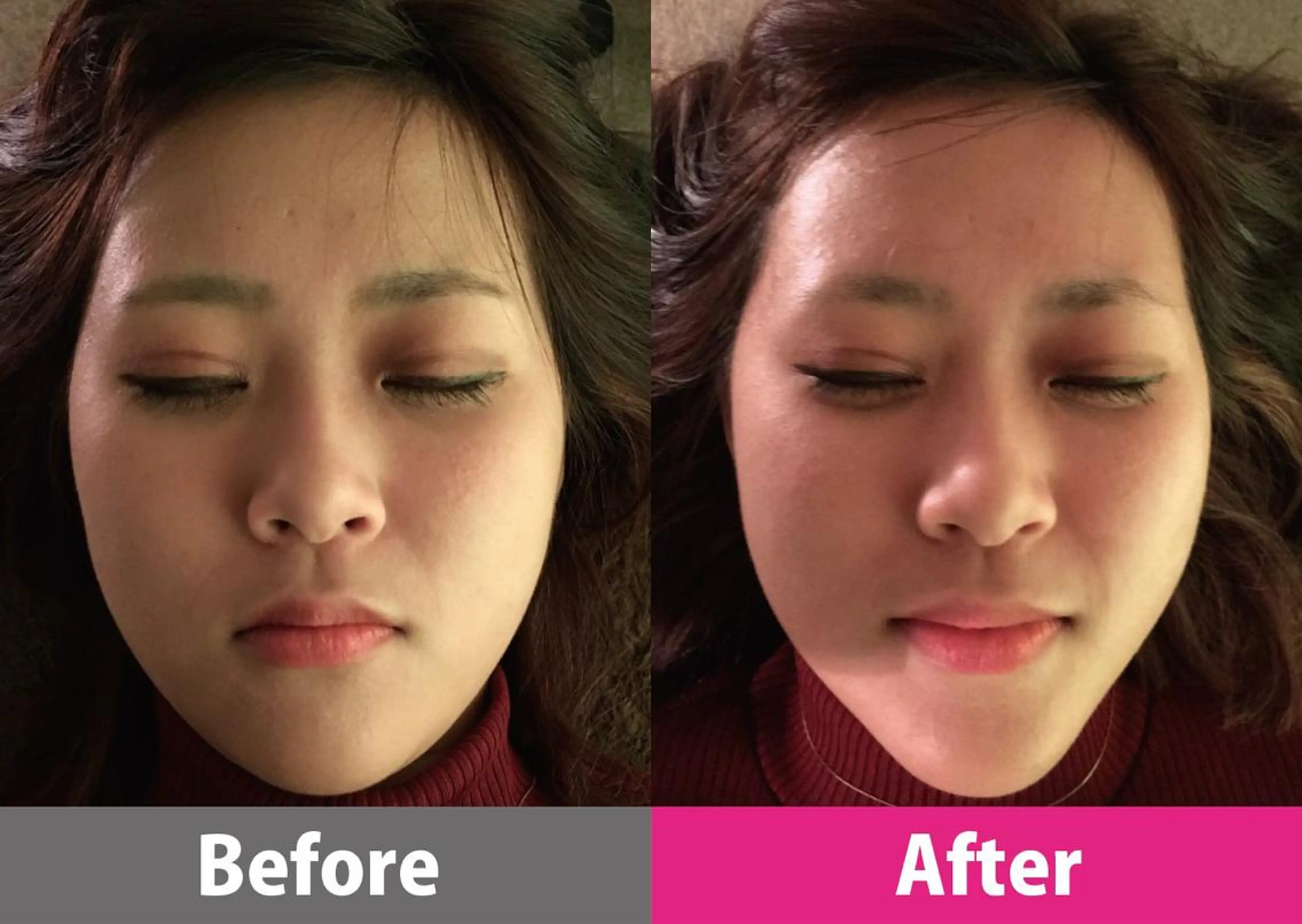 【顔面整体 アルソワート】のエステ・リラクイメージ