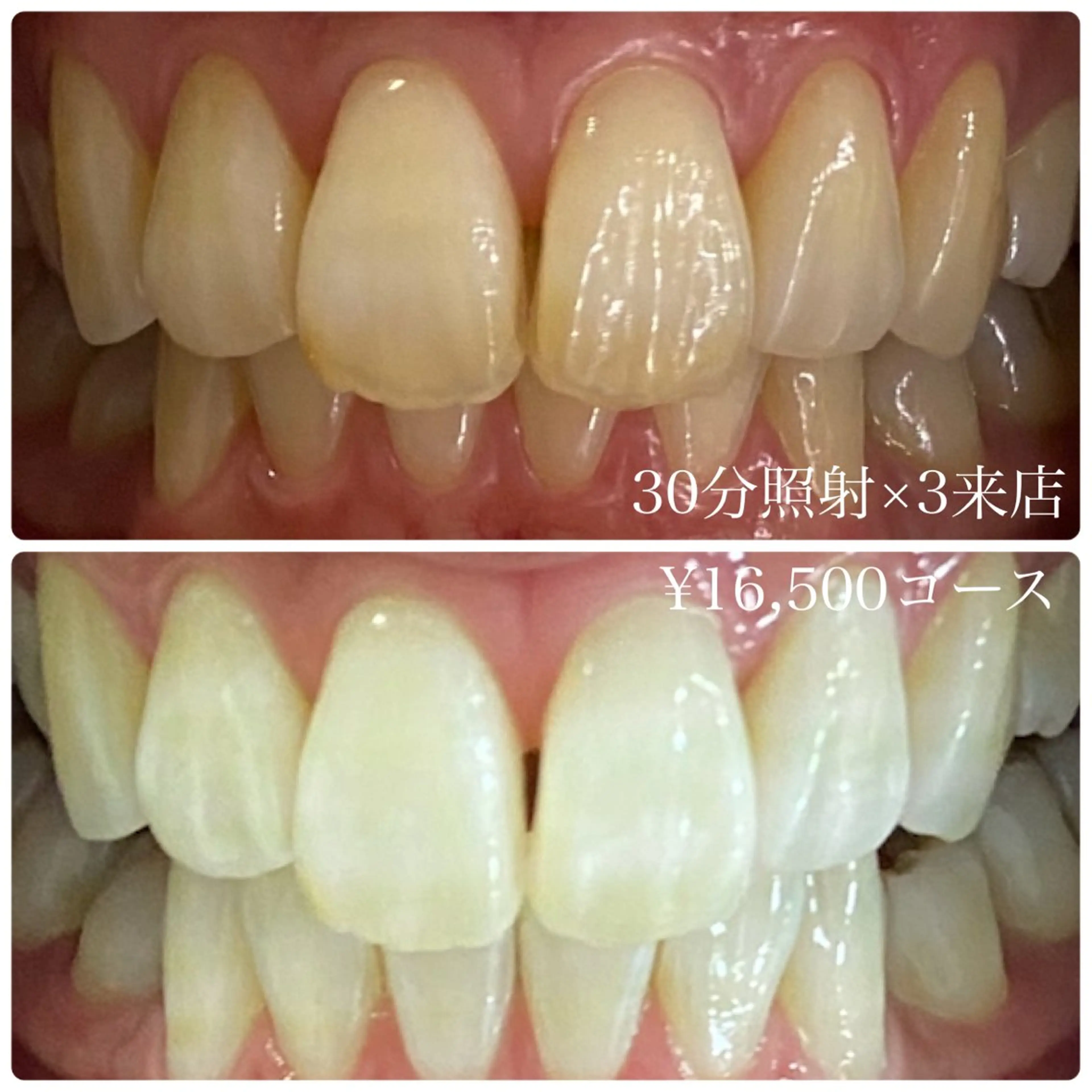 メンズ キッズ その他 ホワイトニングルーム　川崎店所属・ホワイトニング ルーム　川崎店のその他イメージ