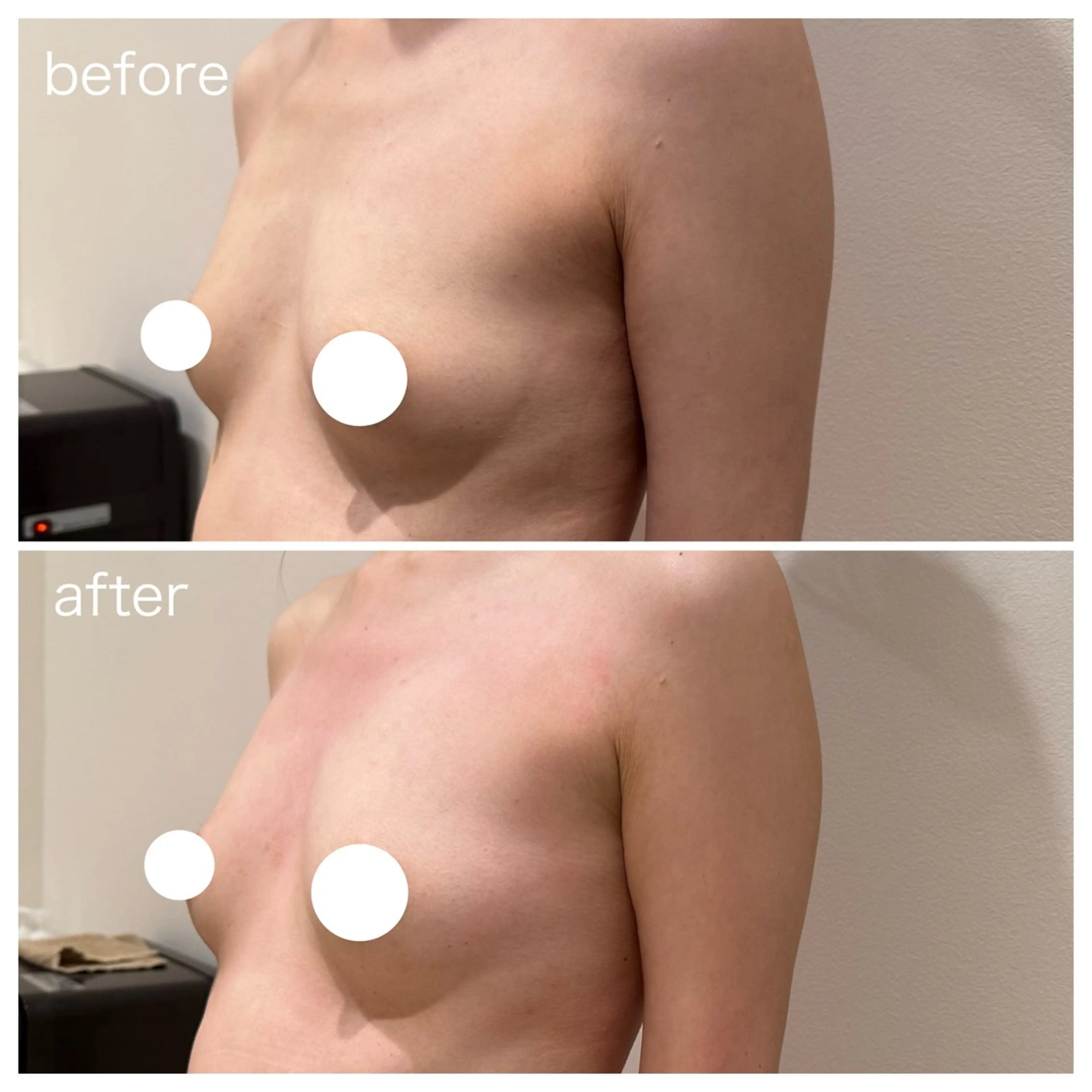 エステ beautysalon RAVIS所属・東大阪/韓国肌管理/ 痩身バスト専門店のエステ・リラクイメージ