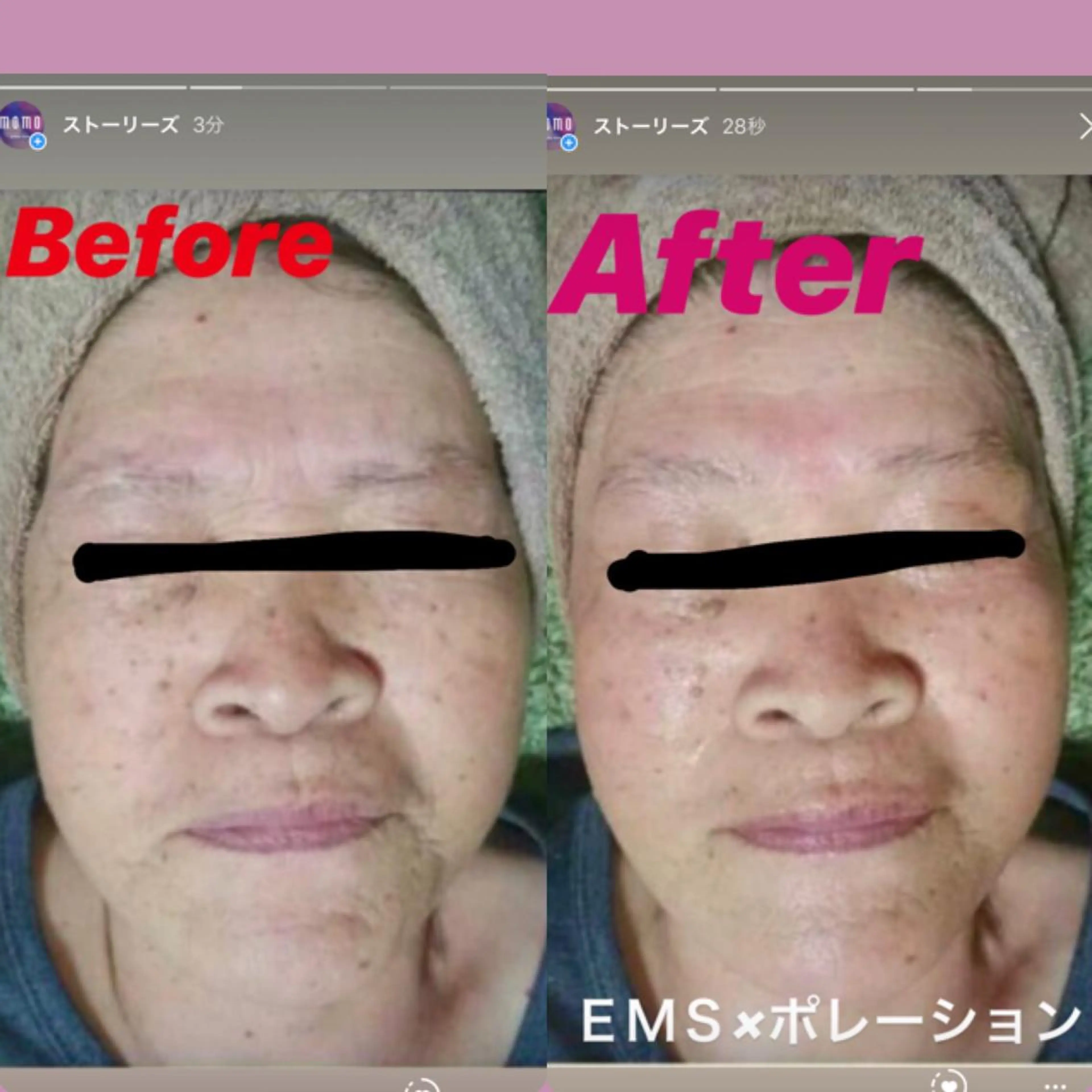 ヘアアレンジ 代表 MOMOのエステ・リラクイメージ