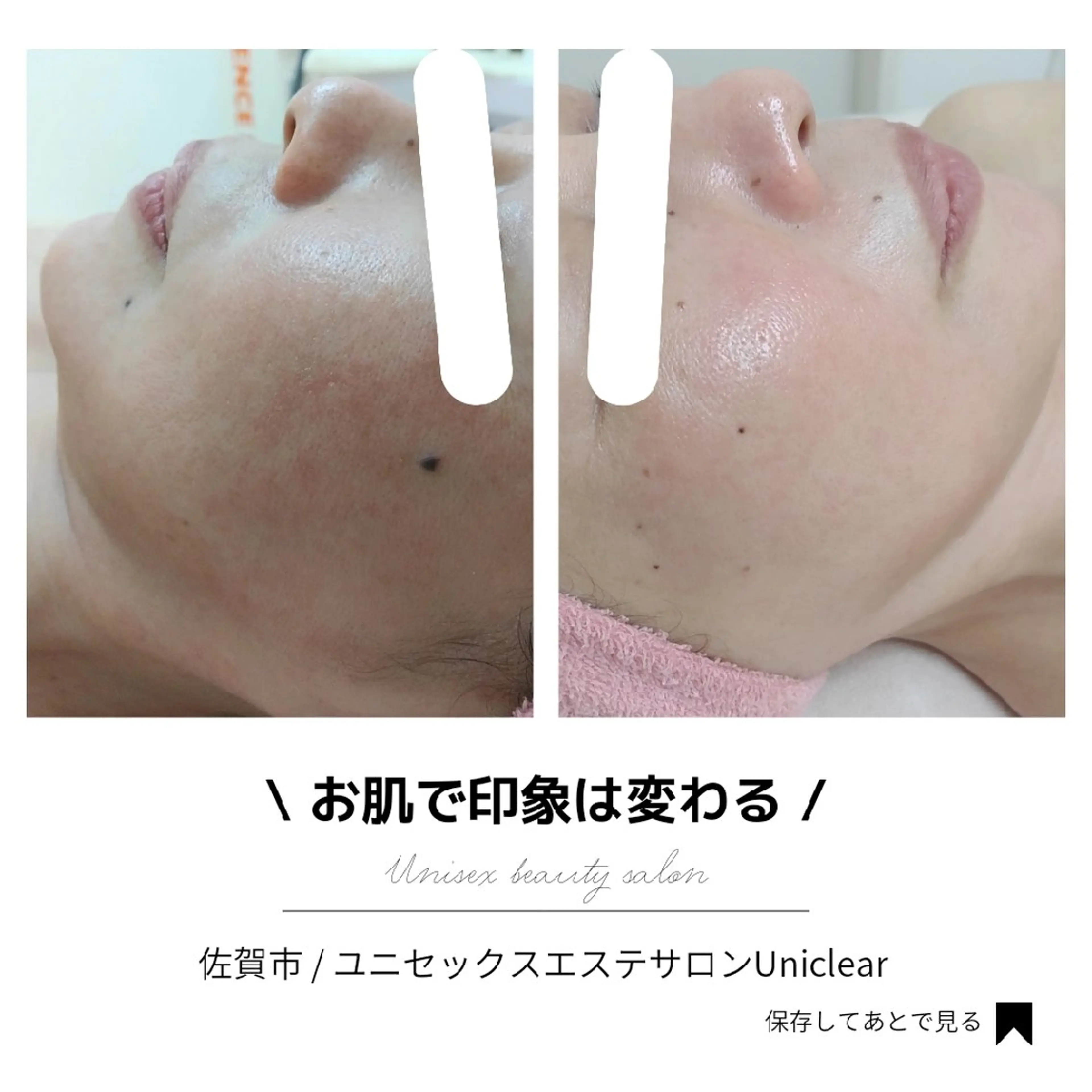 ユニセックスエステサロンUniclear所属・痩身&フェイシャル Uniclearのエステ・リラクイメージ
