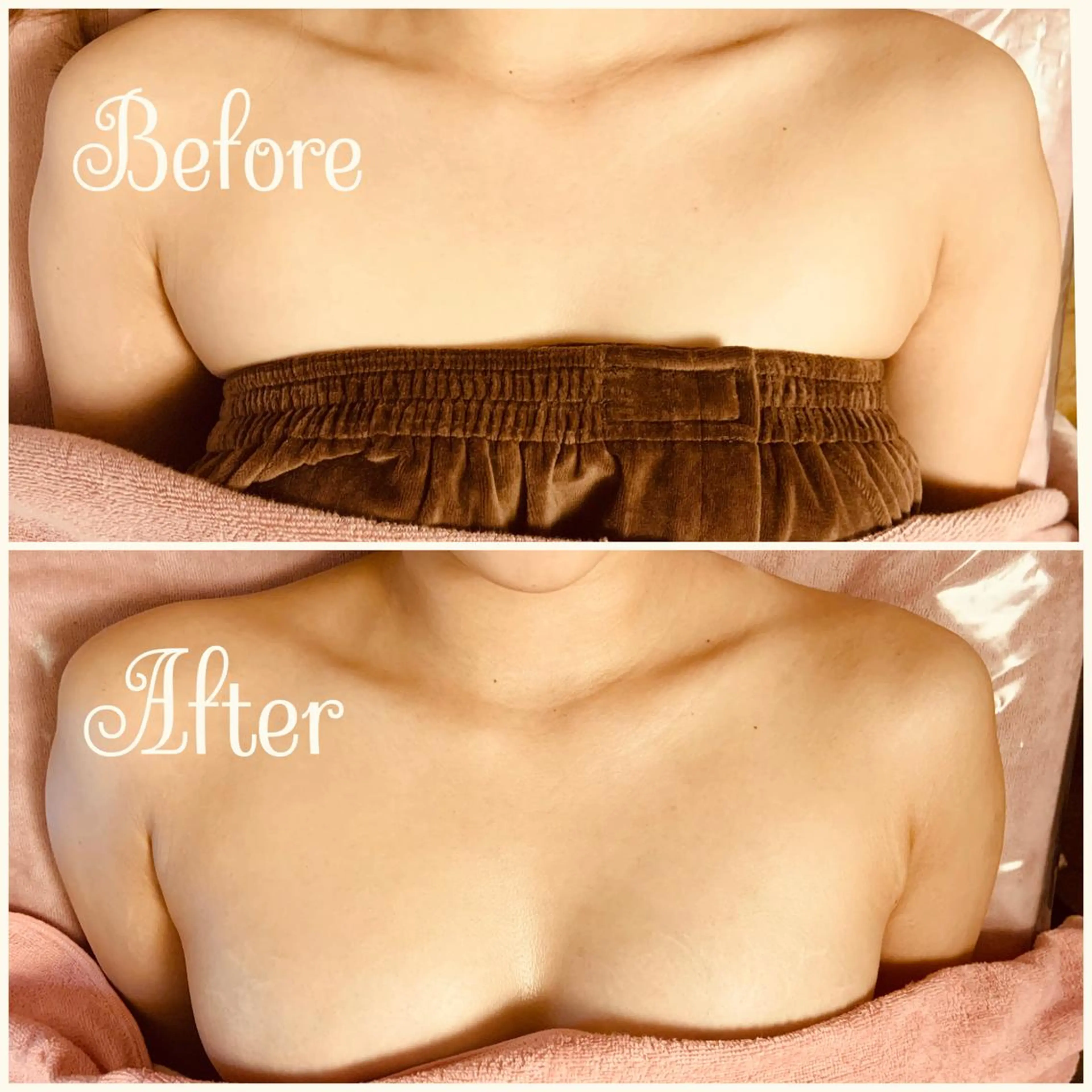 エステ リラク 透明感の肌Lino malieのエステ・リラクイメージ