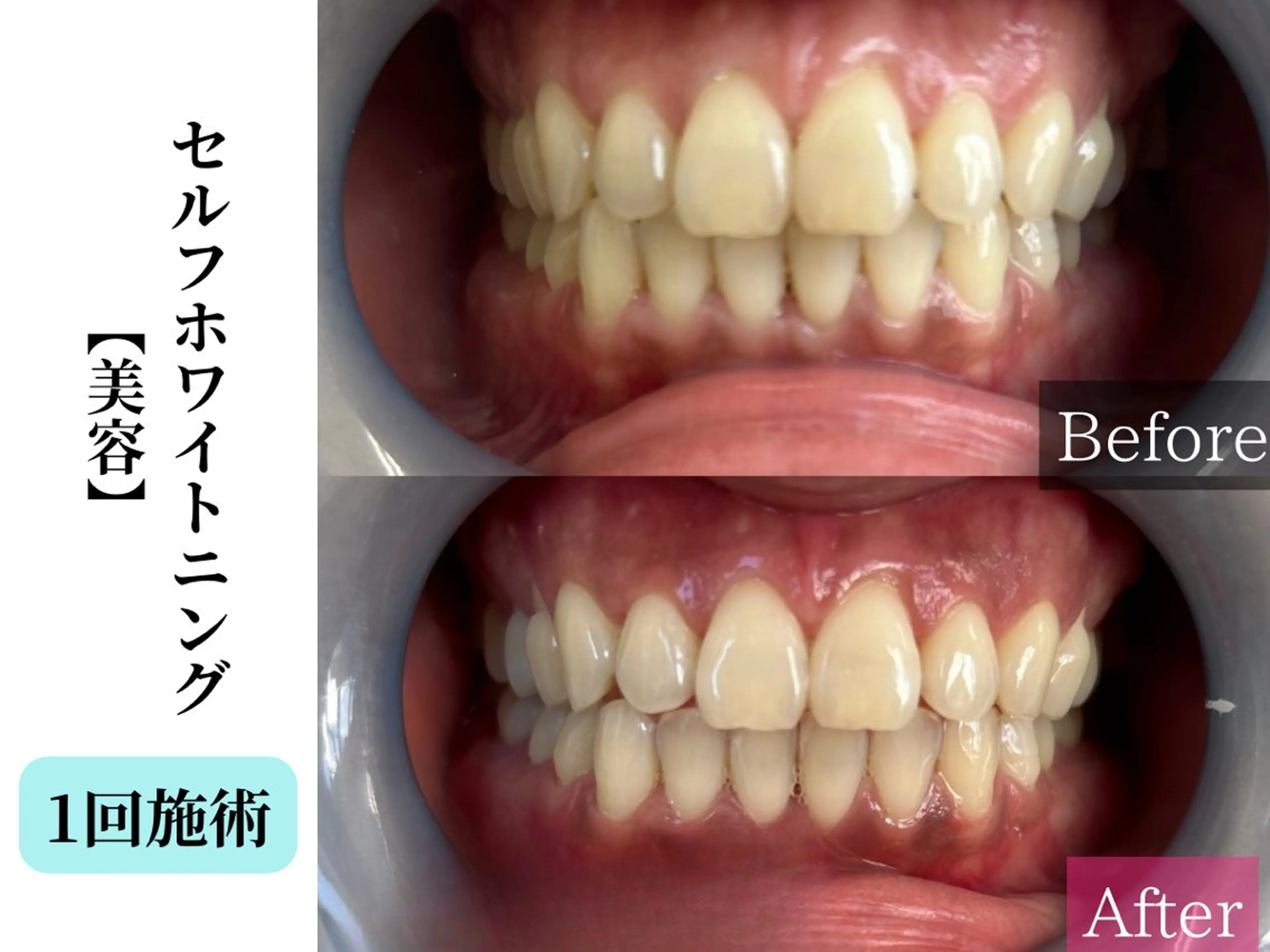 エステ Belle White所属・本格痩身＊肌質改善＊ BelleWhiteのエステ・リラクイメージ