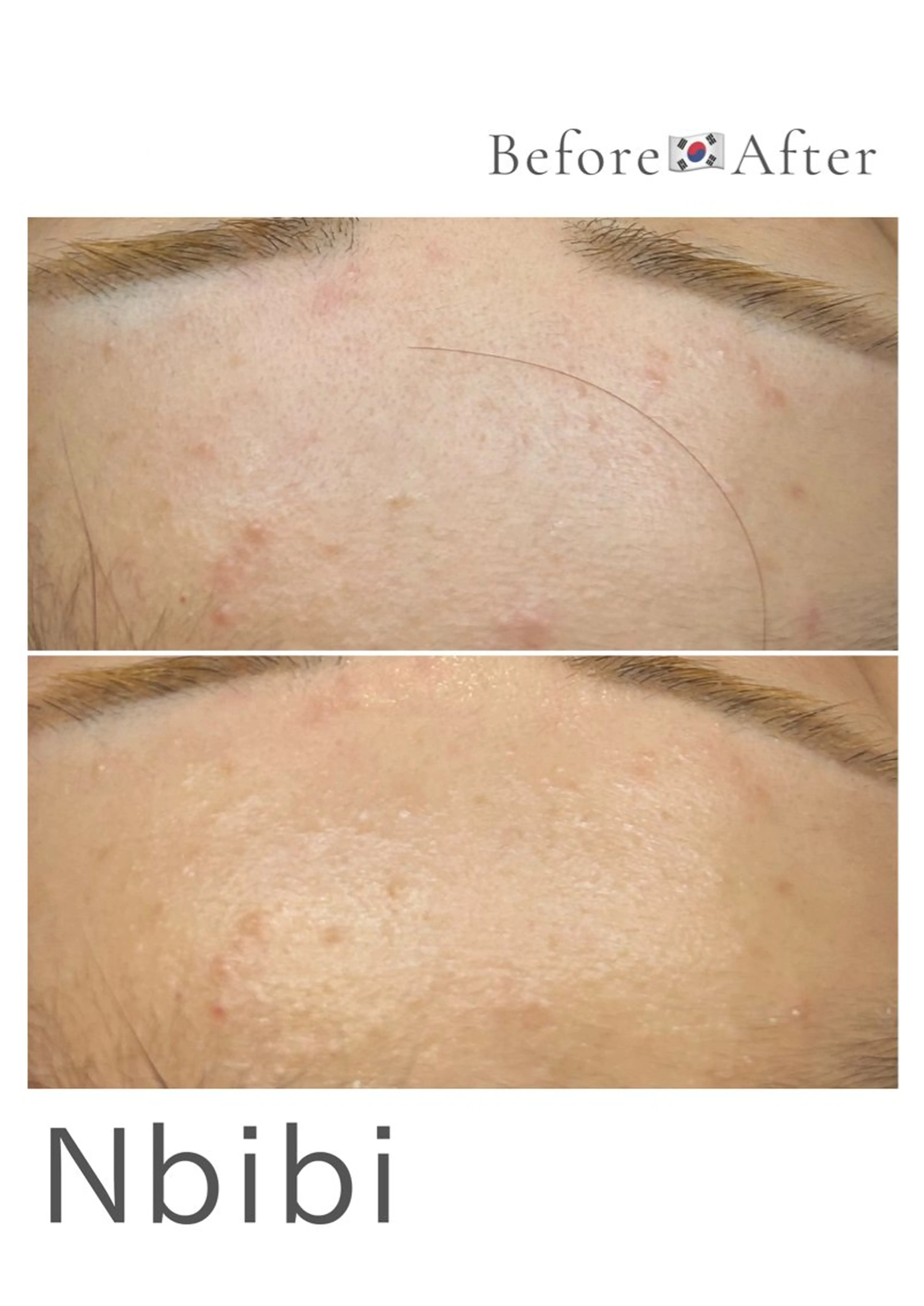 韓国🇰🇷価格 サロン_Nbibiのエステ・リラクイメージ