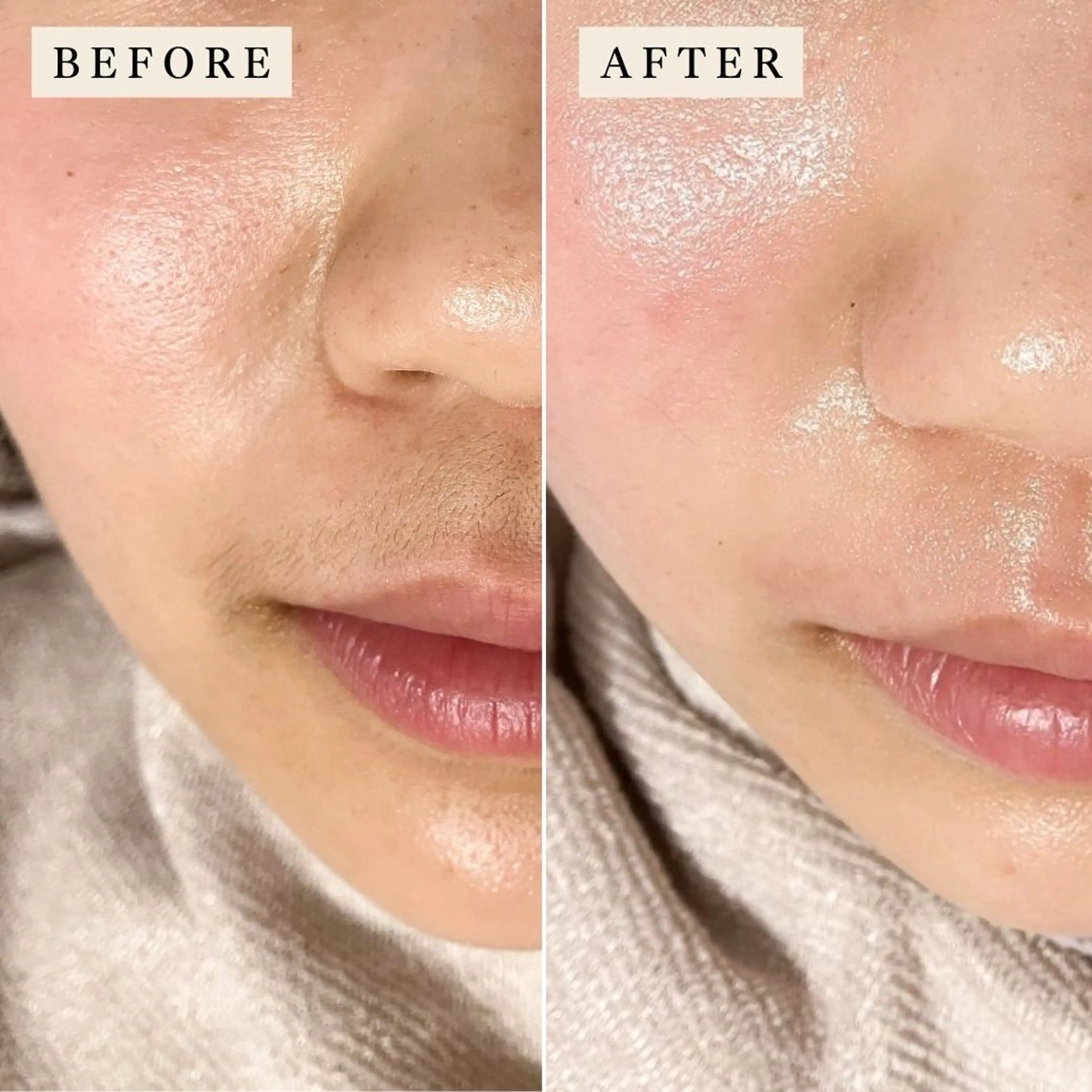 脱毛 【産毛・眉毛ケア＆肌質改善サロン】＊BiBi＊beautysalon所属・眉･産毛専門BiBi 糸脱毛スレッティングのエステ・リラクイメージ