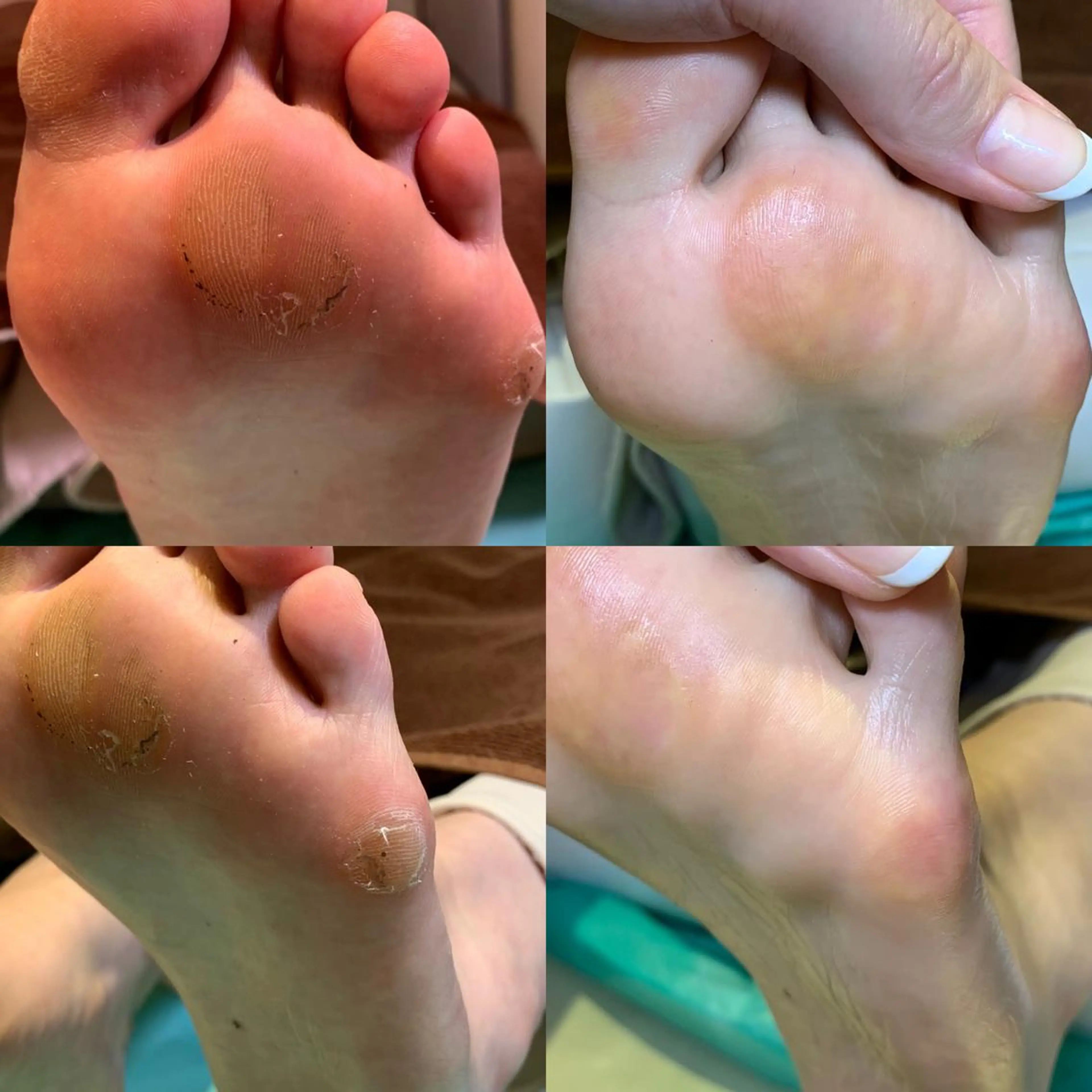 東京巻き爪アカデミー所属・東京巻き爪 アカデミーのエステ・リラクイメージ