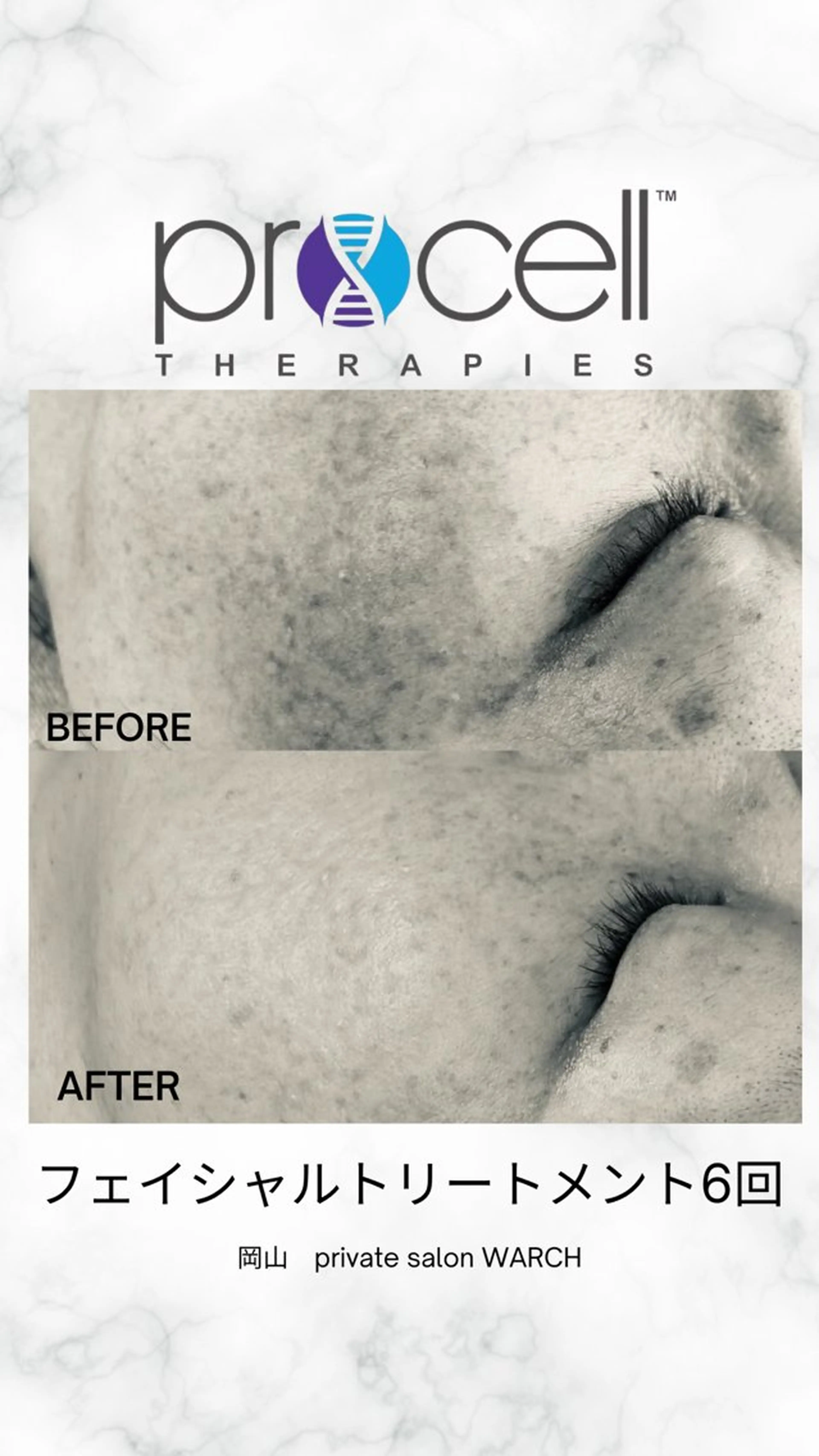 WARCH Marieのその他イメージ