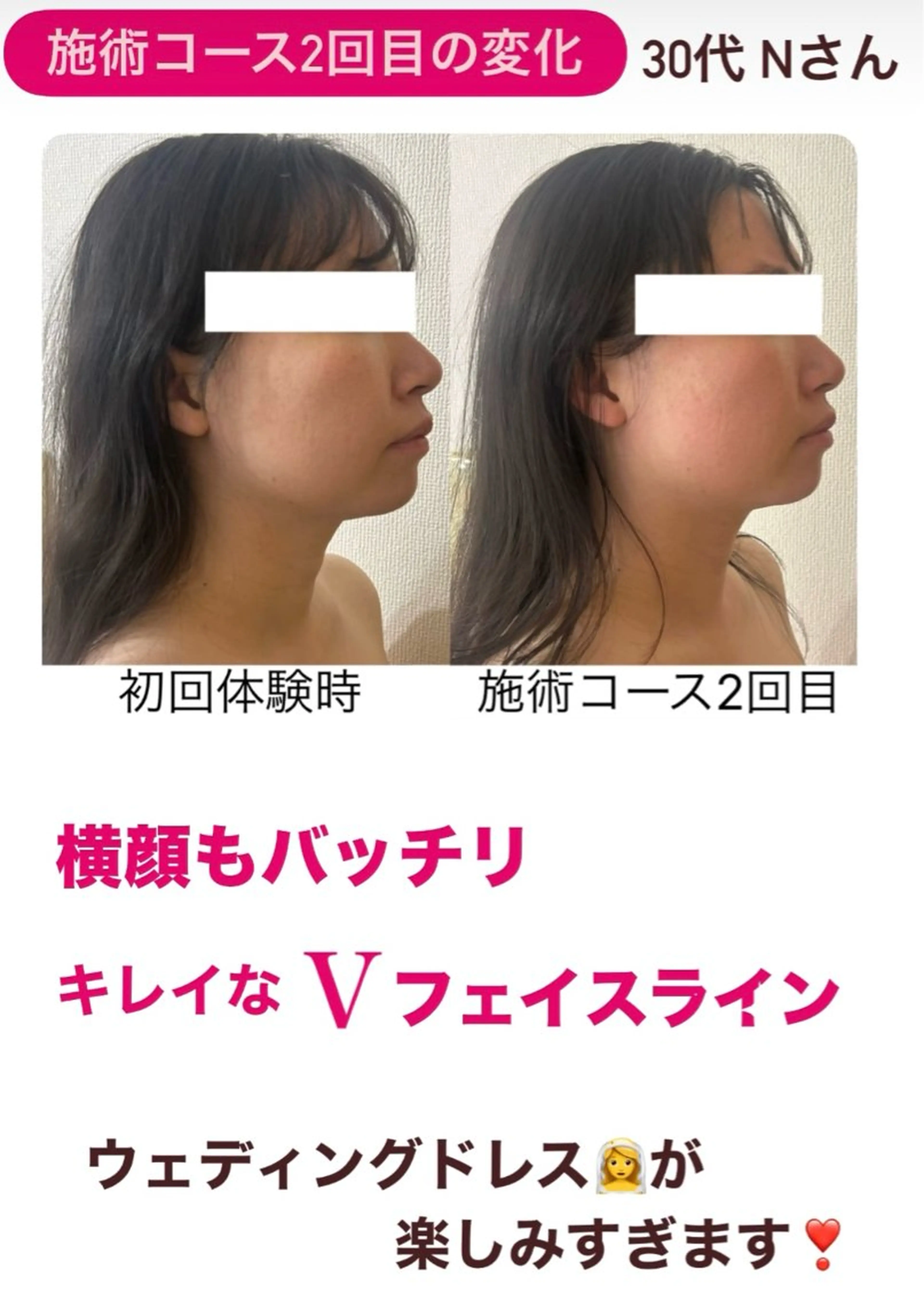 la lumie're (ラ リュミエール)所属・小顔サロン (ラ リュミエール)のエステ・リラクイメージ