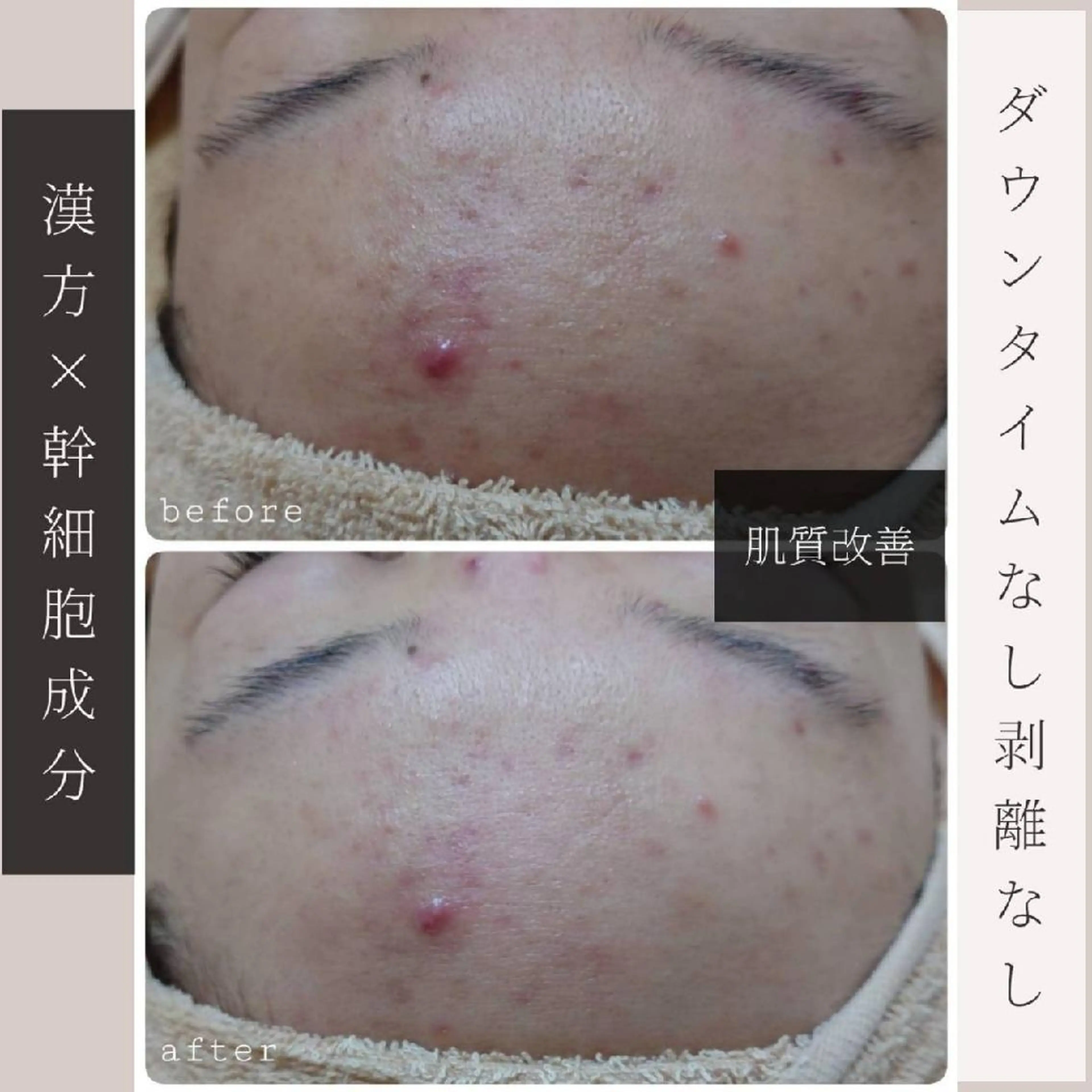 エステ リラク Glossy salonのエステ・リラクイメージ