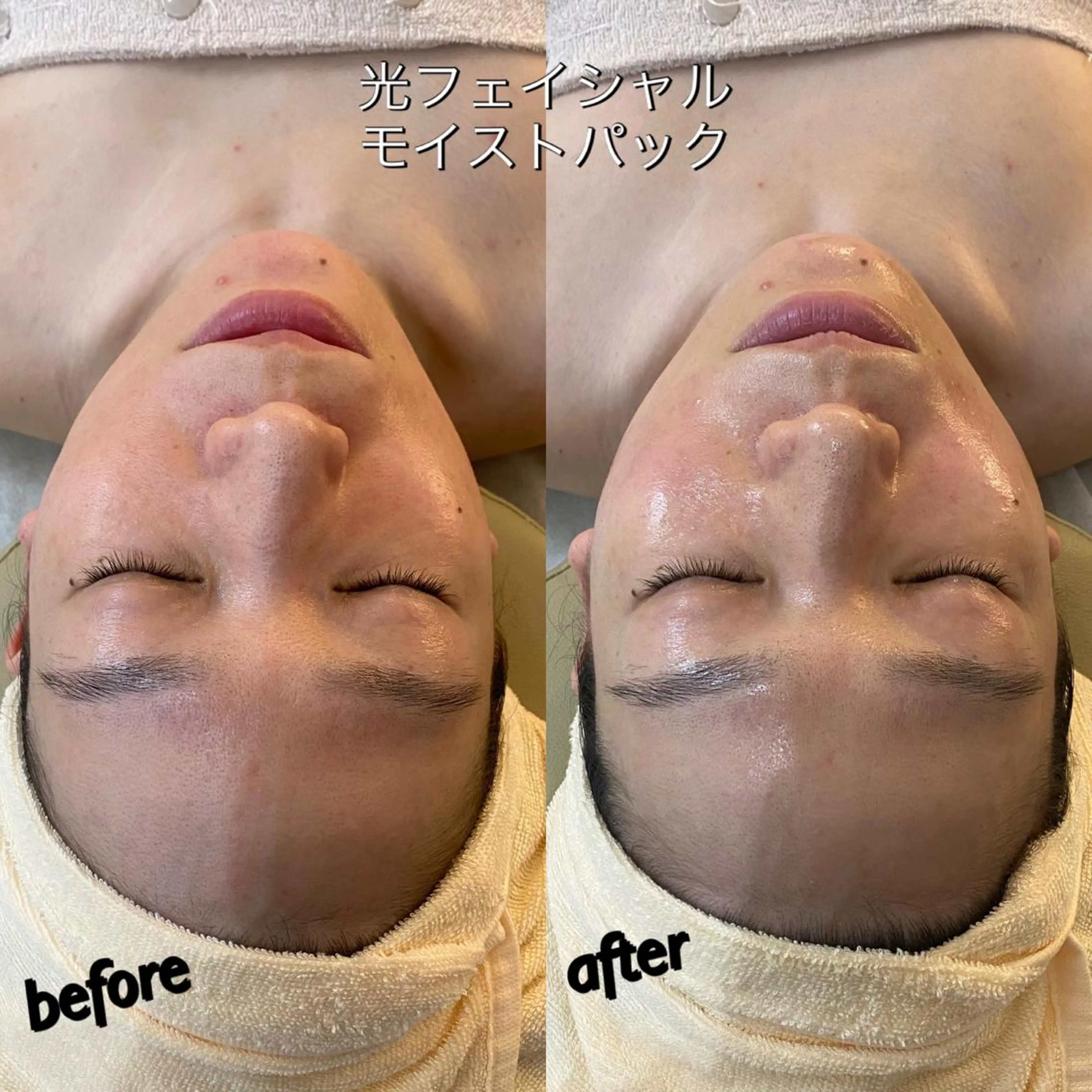 うなじ脱毛/美肌脱毛 LABELのエステ・リラクイメージ