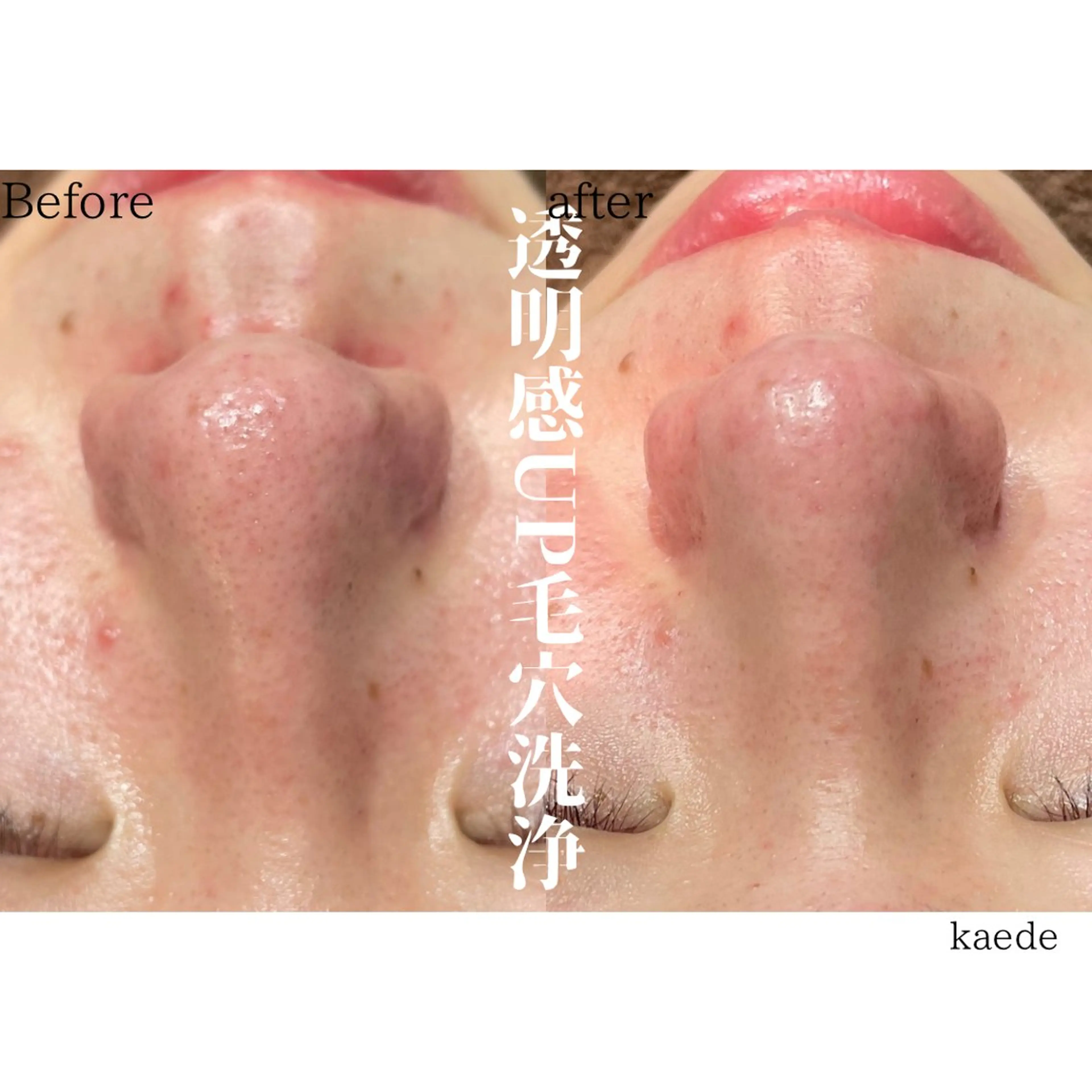 エステ 🎀kaede🎀 骨格似合わせ眉毛の眉毛・アイブロウイメージ