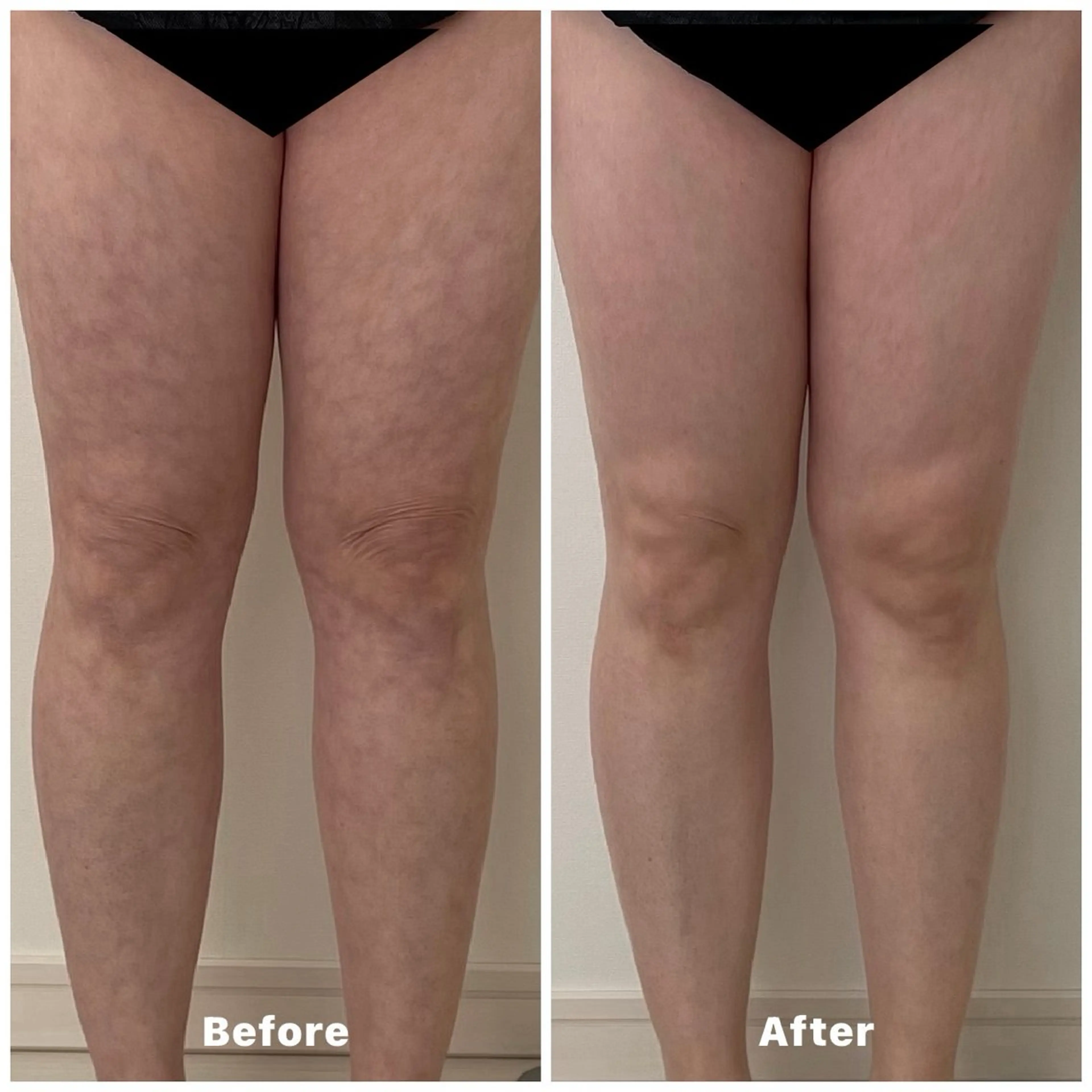 エステ リラク 心と体が整う腸活 サロン ラクシュミーのその他イメージ