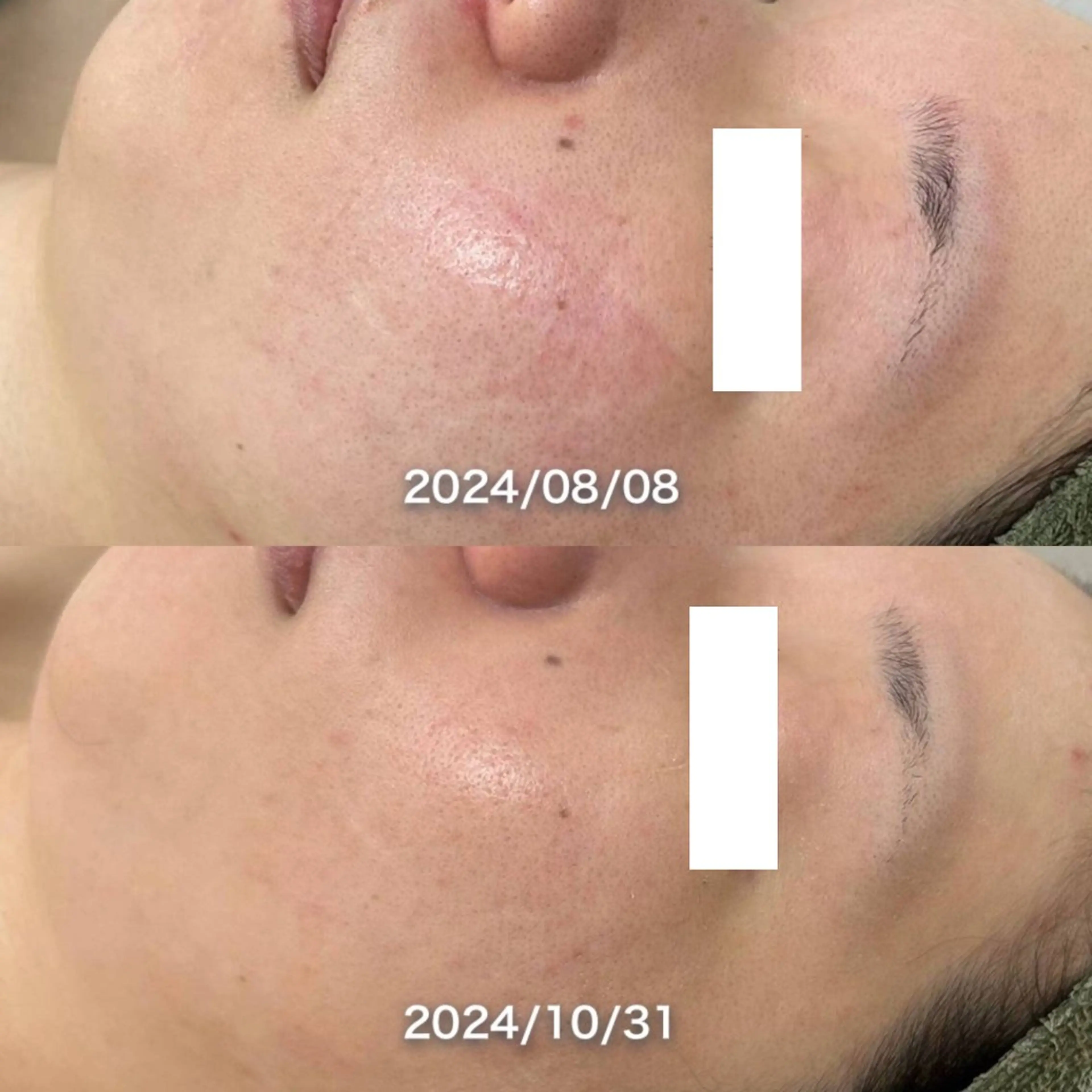 韓国美肌/肌質改善 【天神】yuiのエステ・リラクイメージ