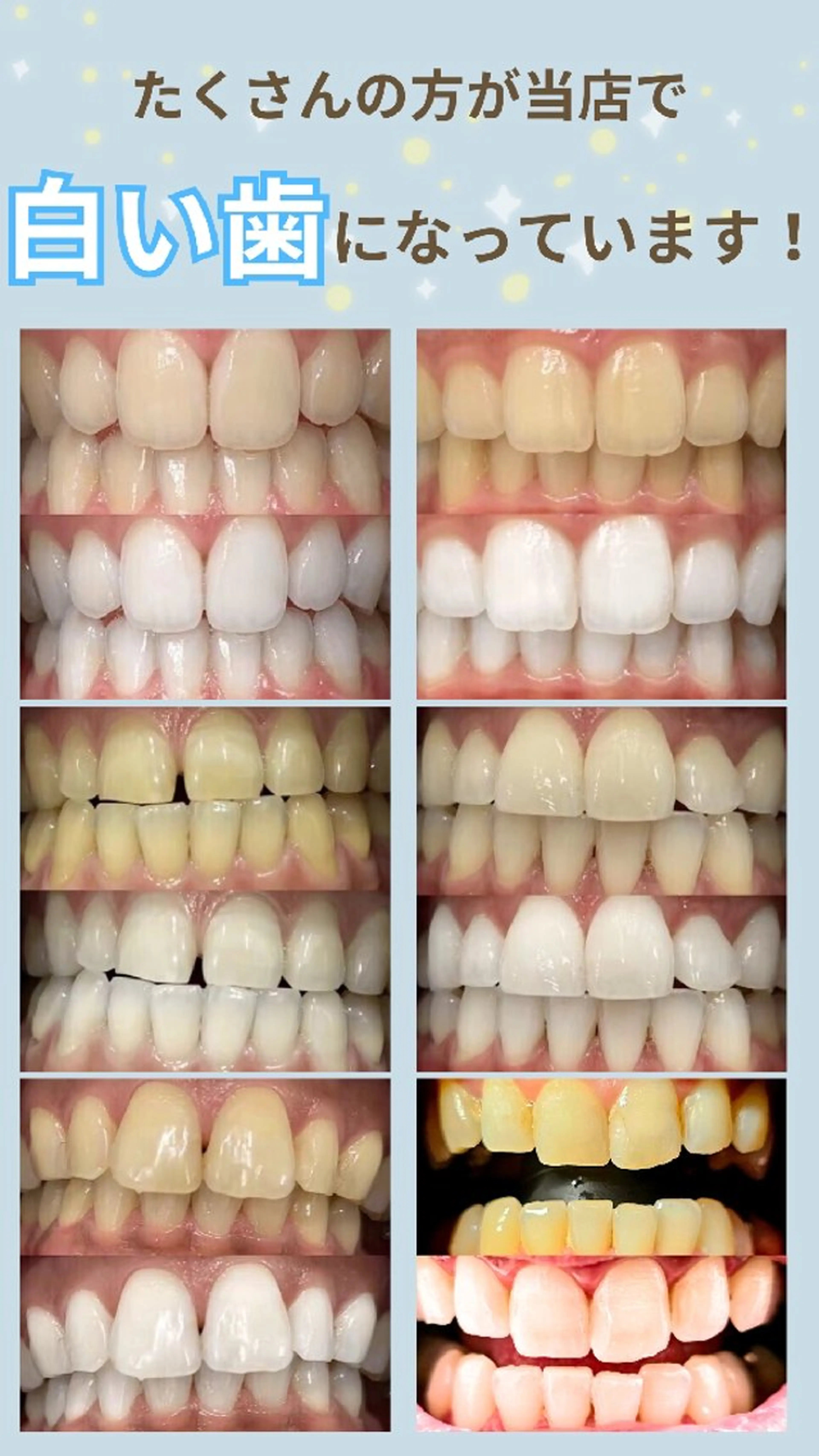 歯科提携セルフダック 宇都宮駒生店のエステ・リラクイメージ