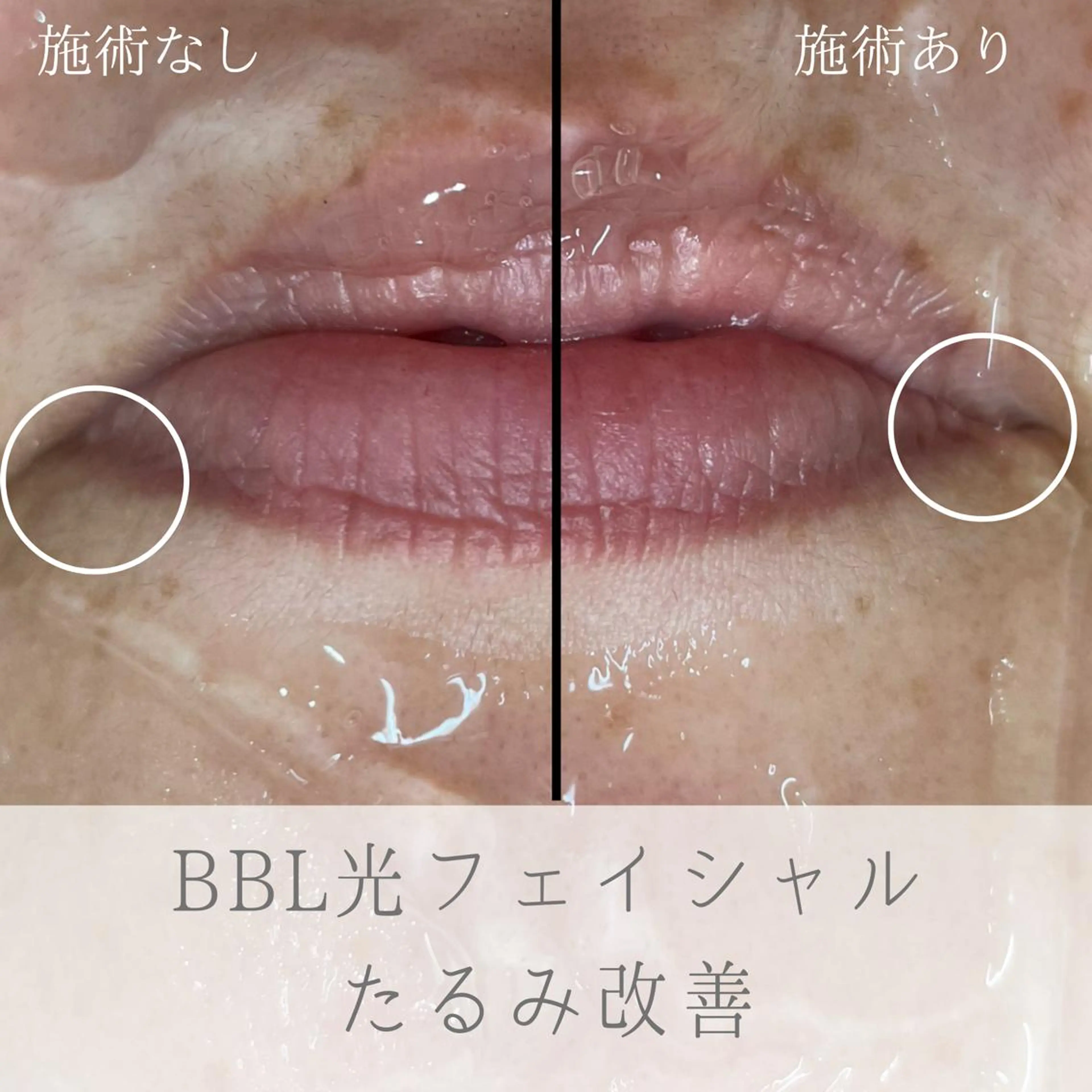 ciena KAYOのその他イメージ