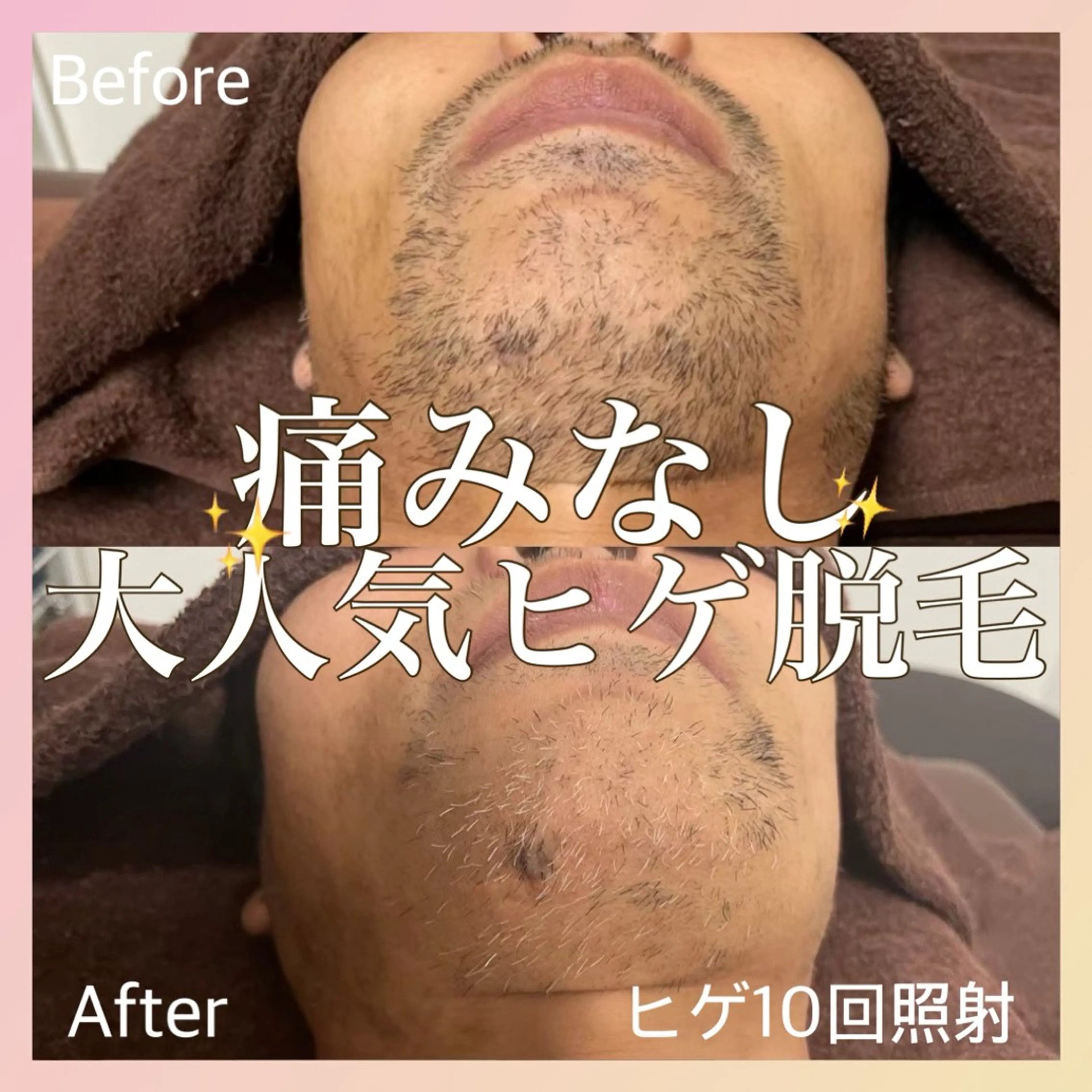 MINOA  大野城店所属・小林 千愛のエステ・リラクイメージ