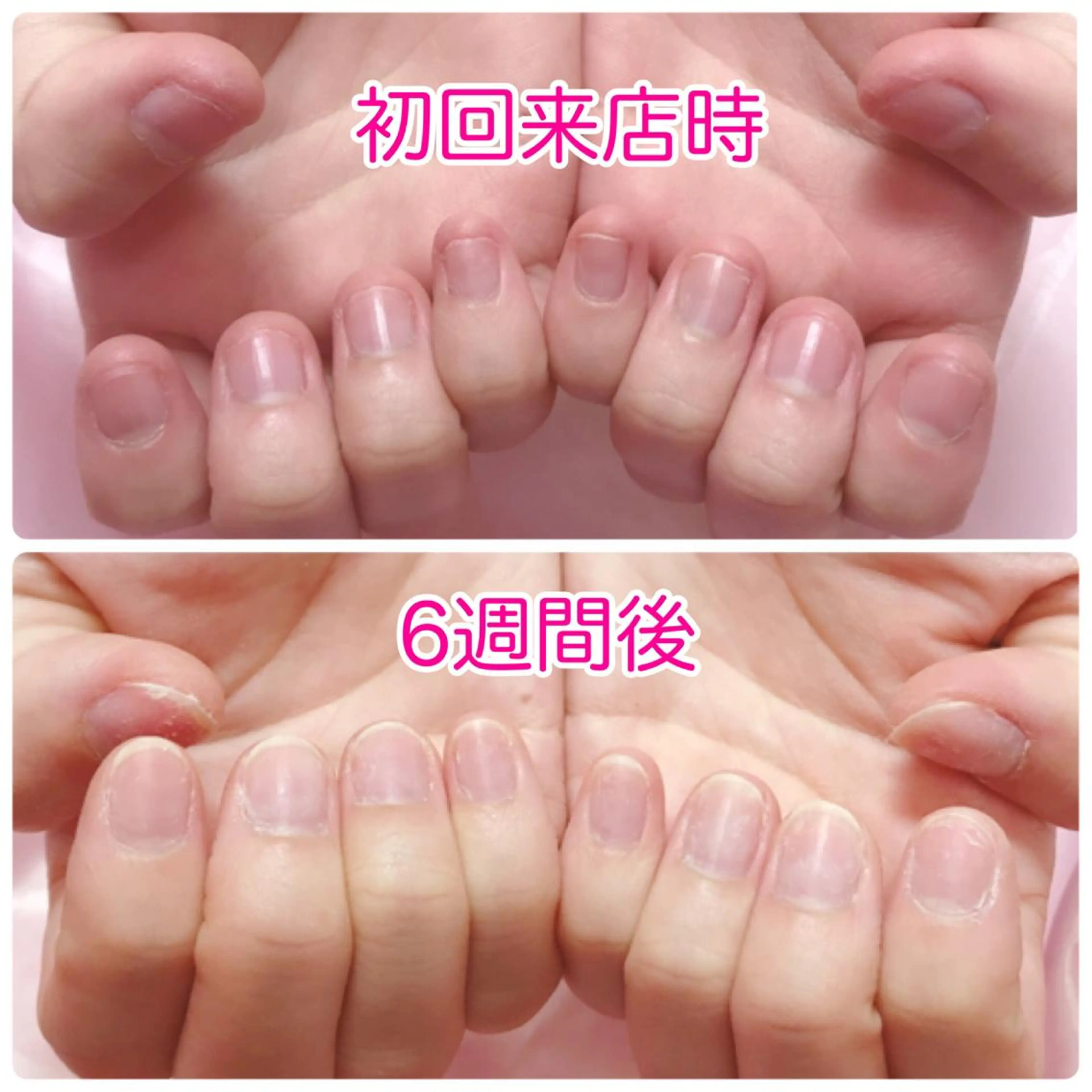 ネイル ハンドネイル 深爪を断らない スカルプ高評価店のネイルデザイン