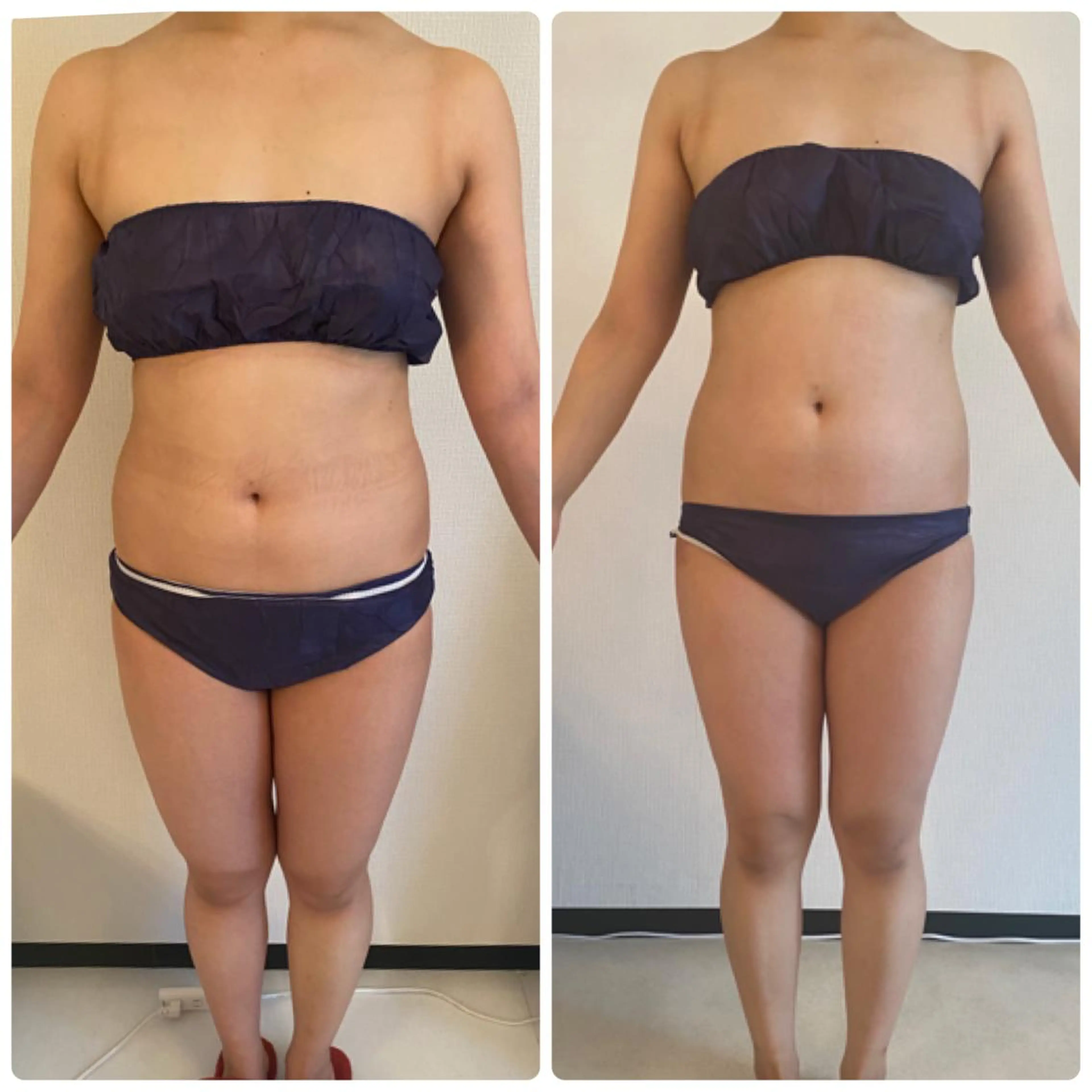 FLEUR大阪・美容 整体・痩身・小顔のエステ・リラクイメージ