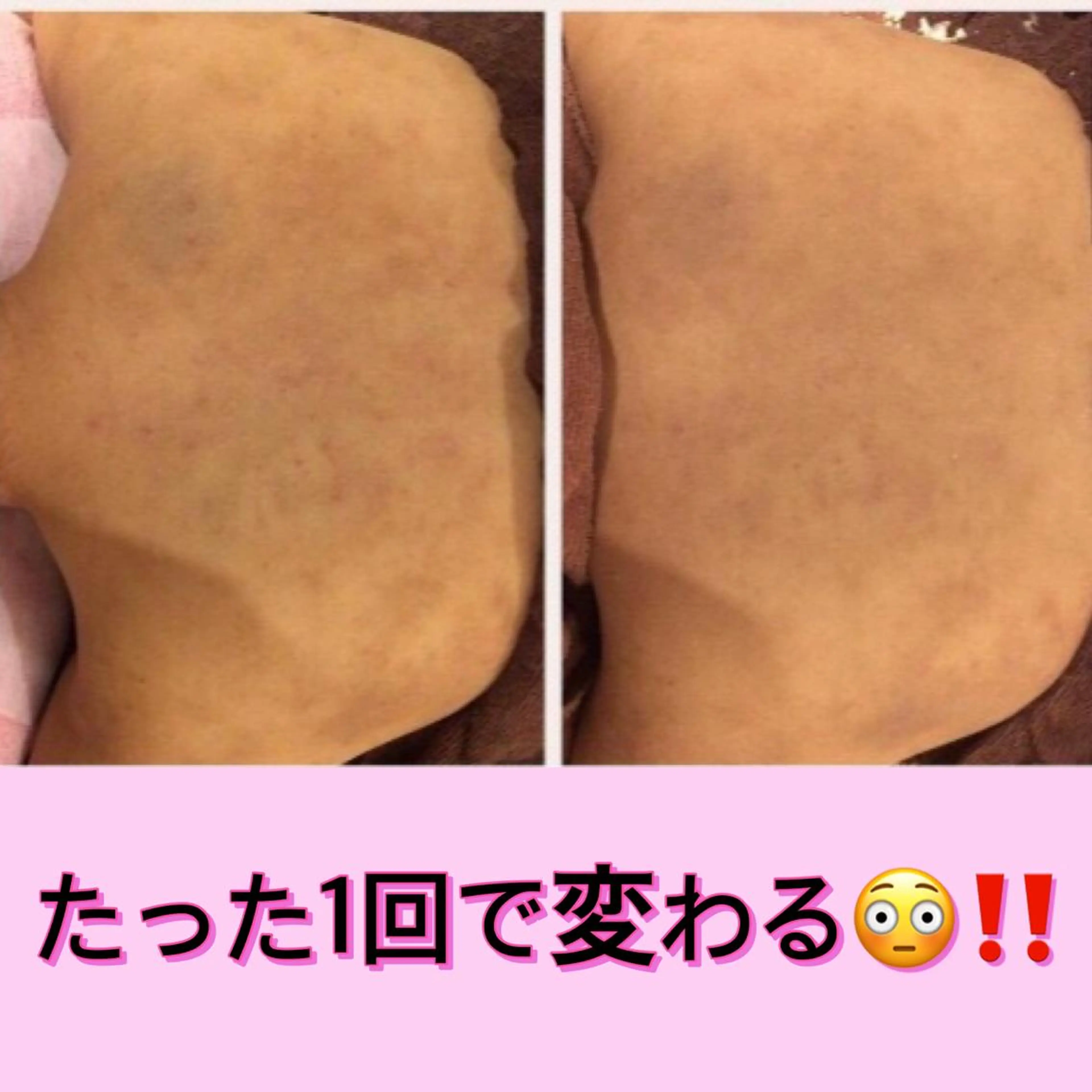 ミディアム カラー パーマ ヘアアレンジ メンズ キッズ ネイル マツエク・マツパ エステ リラク ニキビ・肌質改善専門 ♡人生が変わるサロンのエステ・リラクイメージ