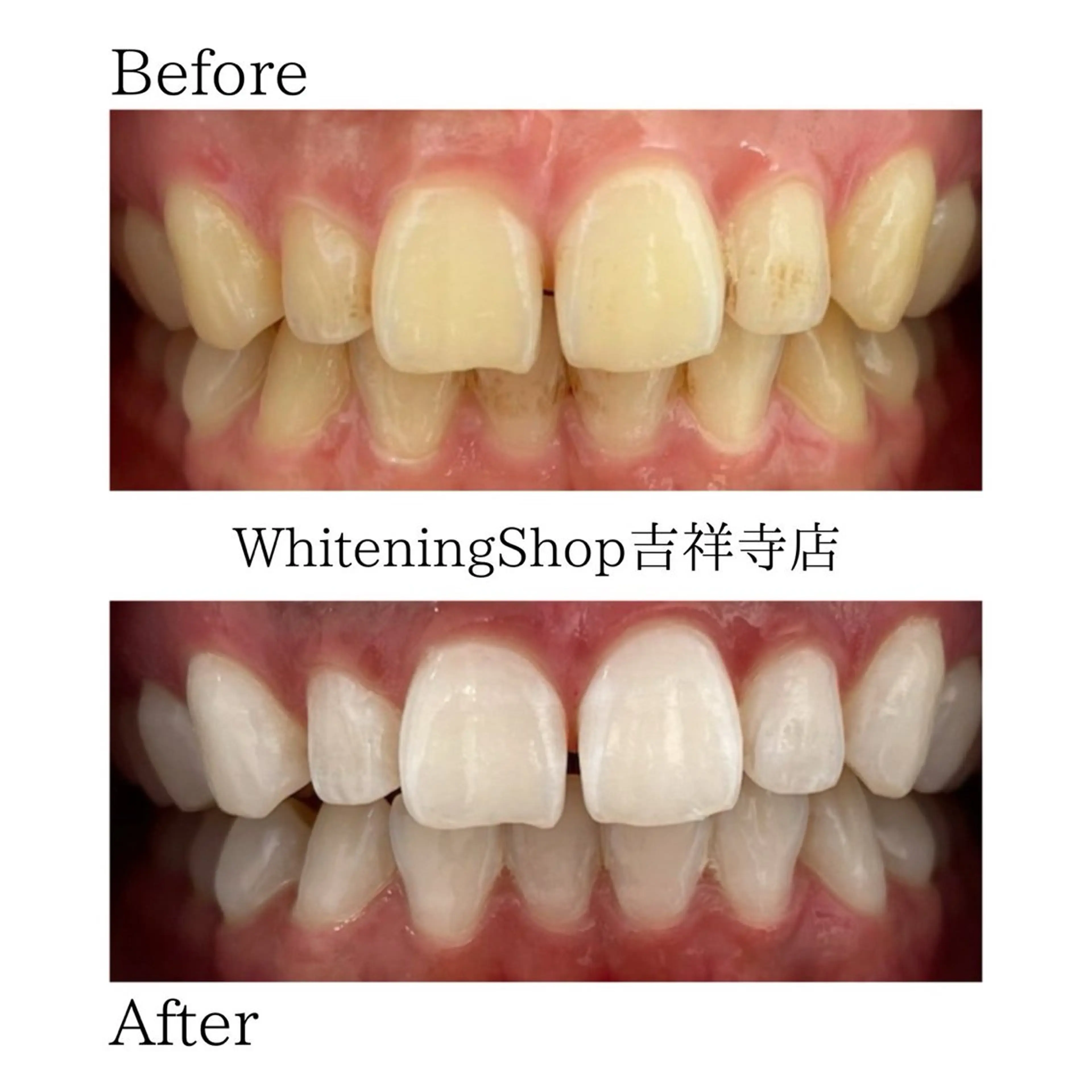 エステ リラク ホワイトニング ショップ吉祥寺店のエステ・リラクイメージ