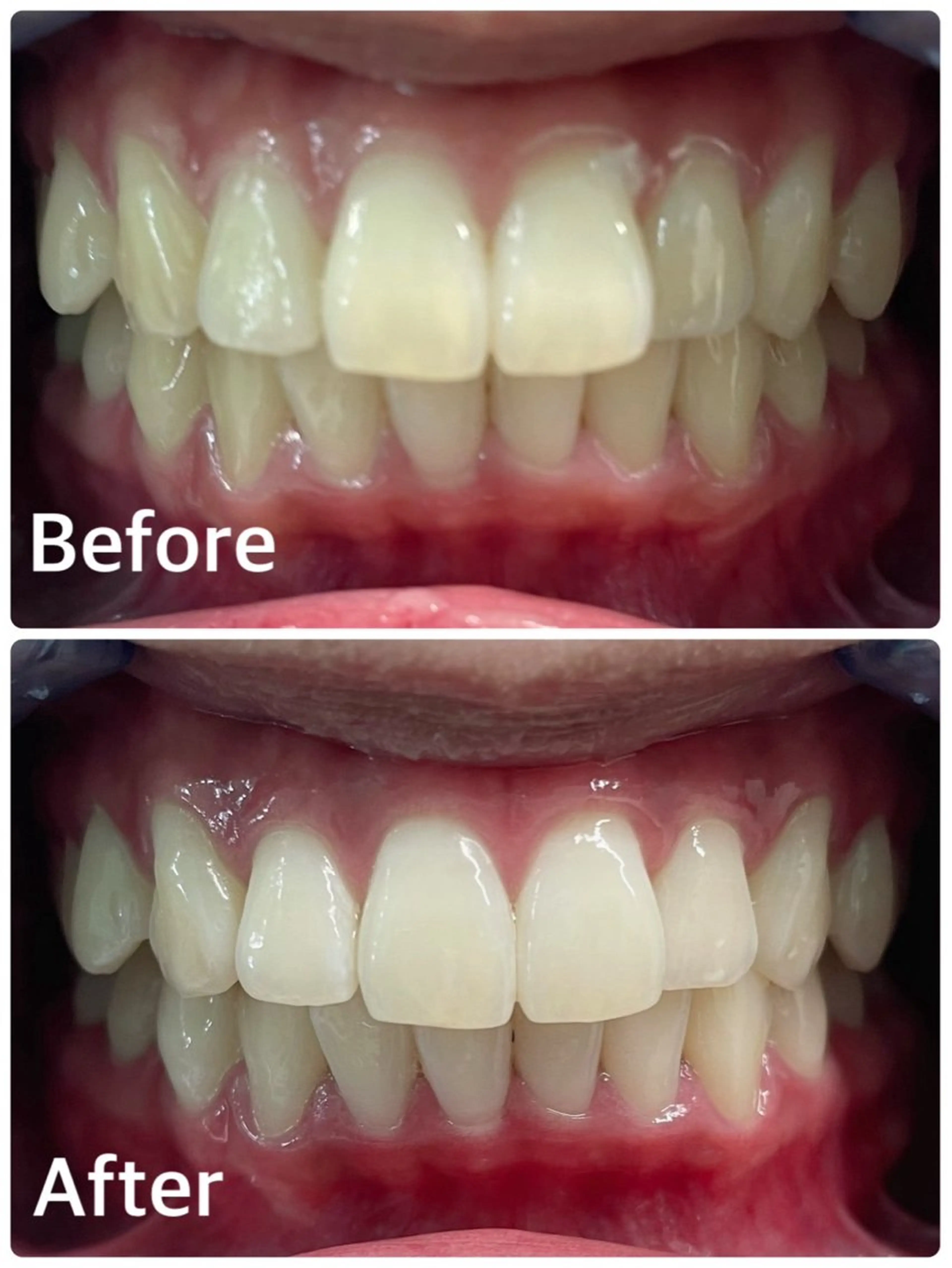 メンズ クリスマス エステ プラチナム ビューティー横須賀店のその他イメージ