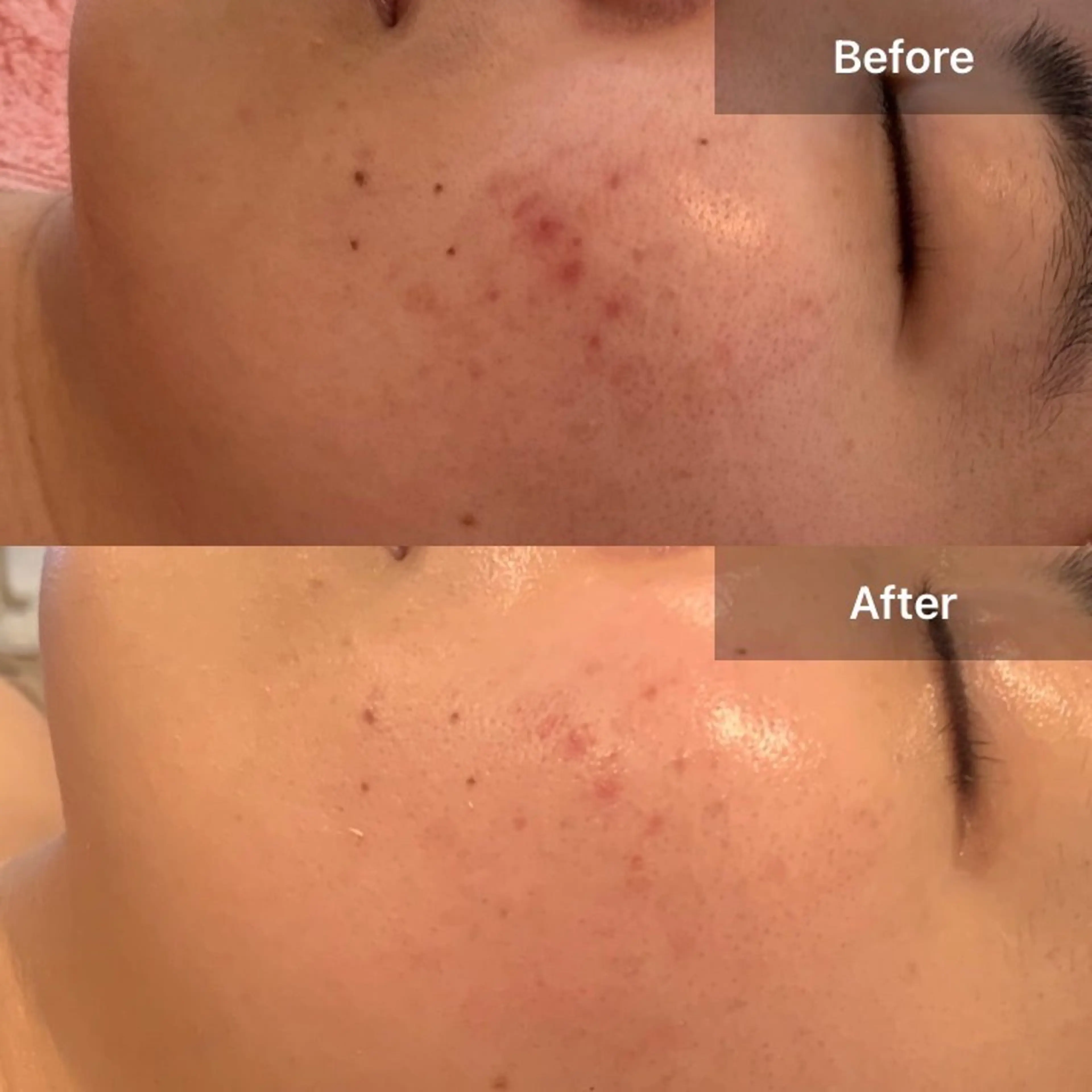 瑞江 しゅぷうるの眉毛・アイブロウイメージ