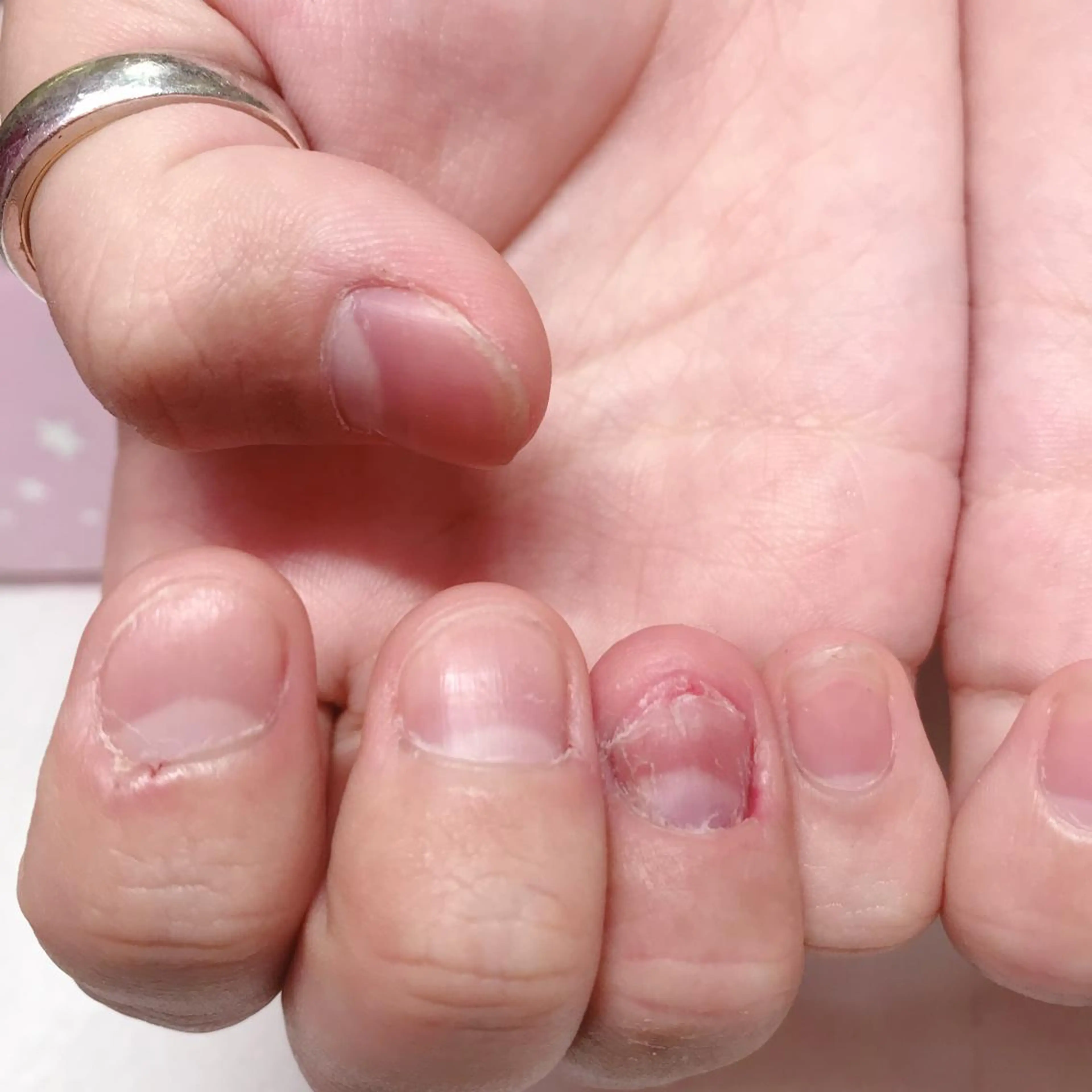 ネイル ハンドネイル 深爪を断らない スカルプ高評価店のネイルデザイン