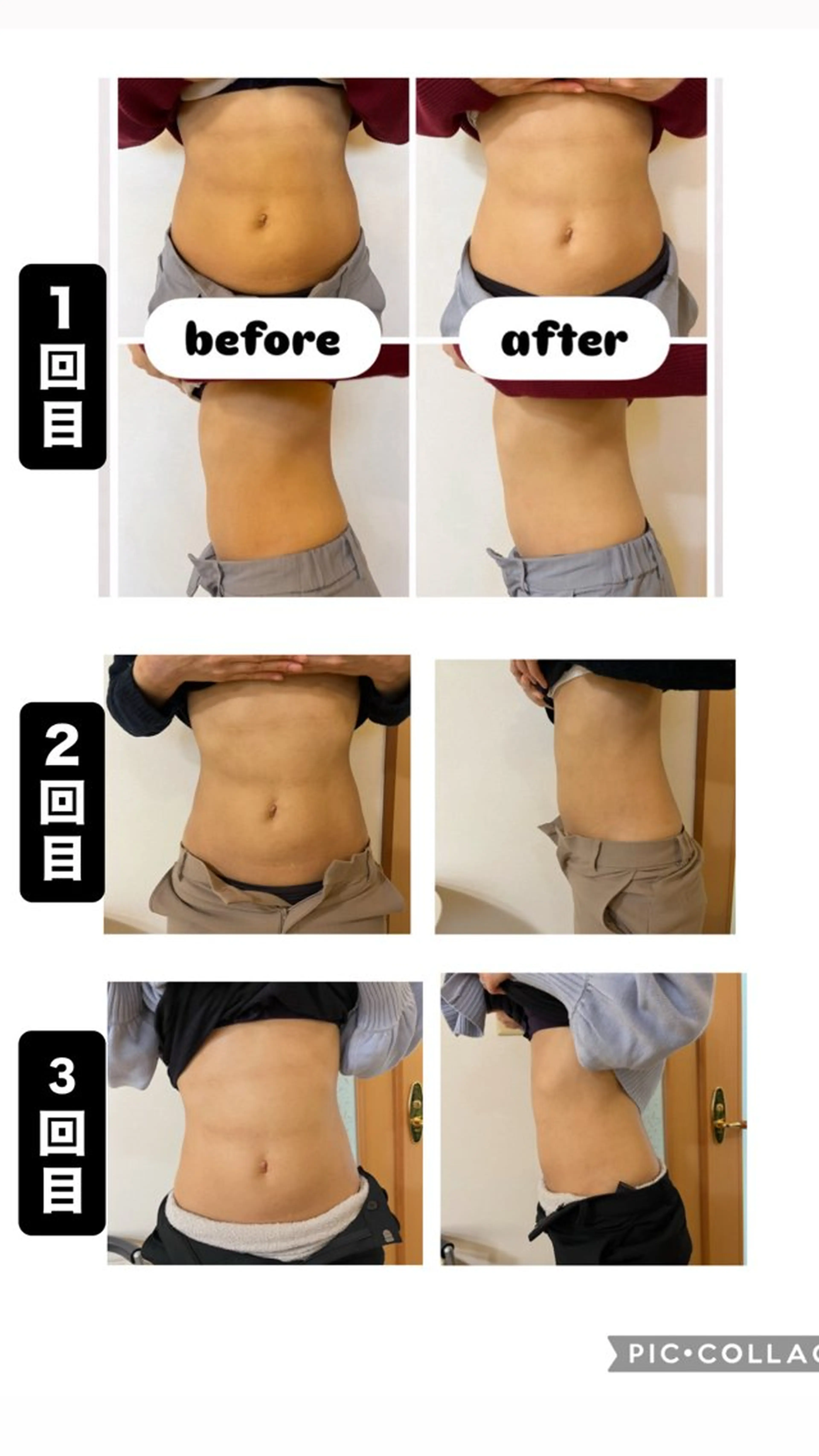 美・腸もみの写真