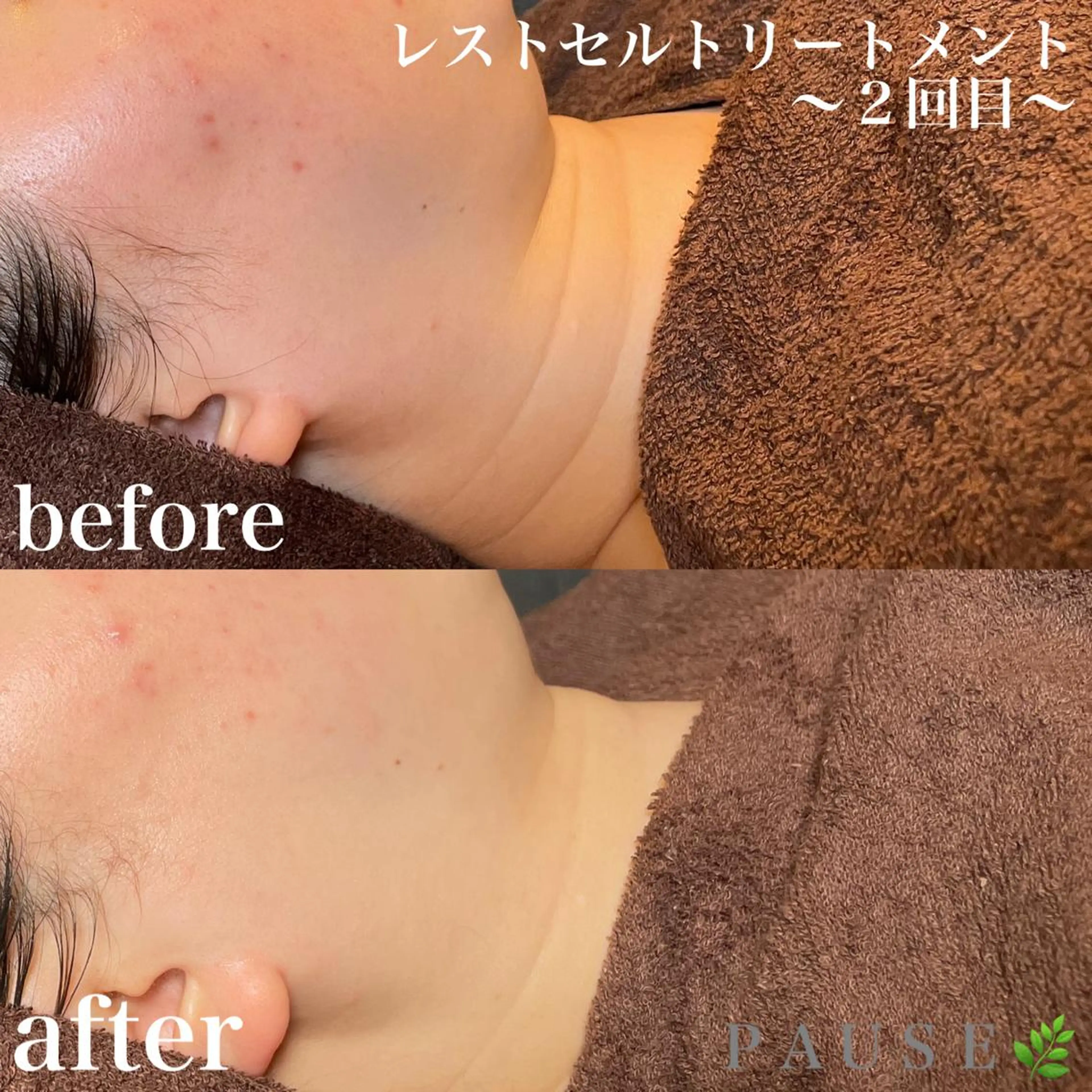 エステ リラク 浜野 恵美のエステ・リラクイメージ