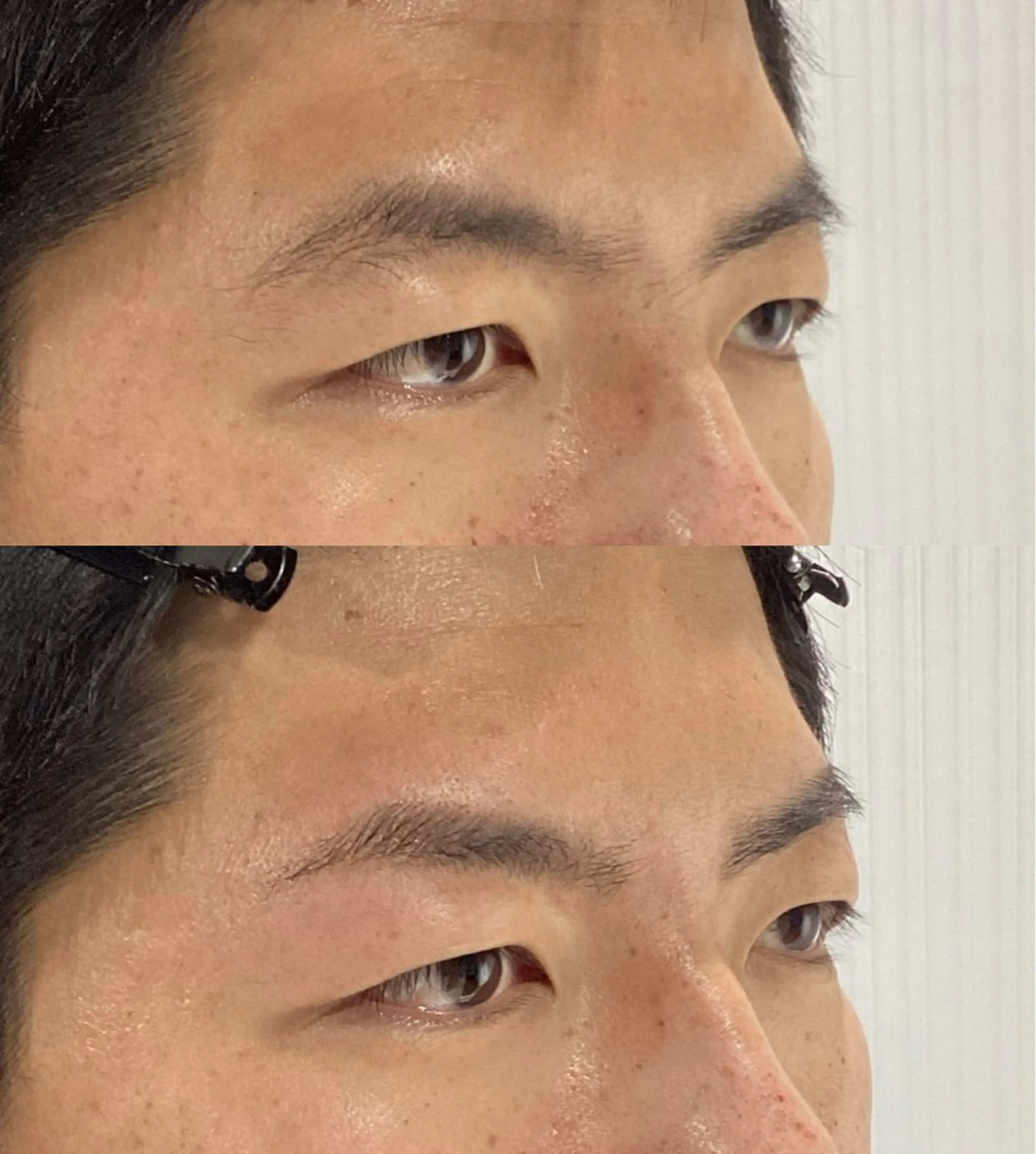 【無料モデル】眉毛ワックス脱毛(メンズ限定)の写真