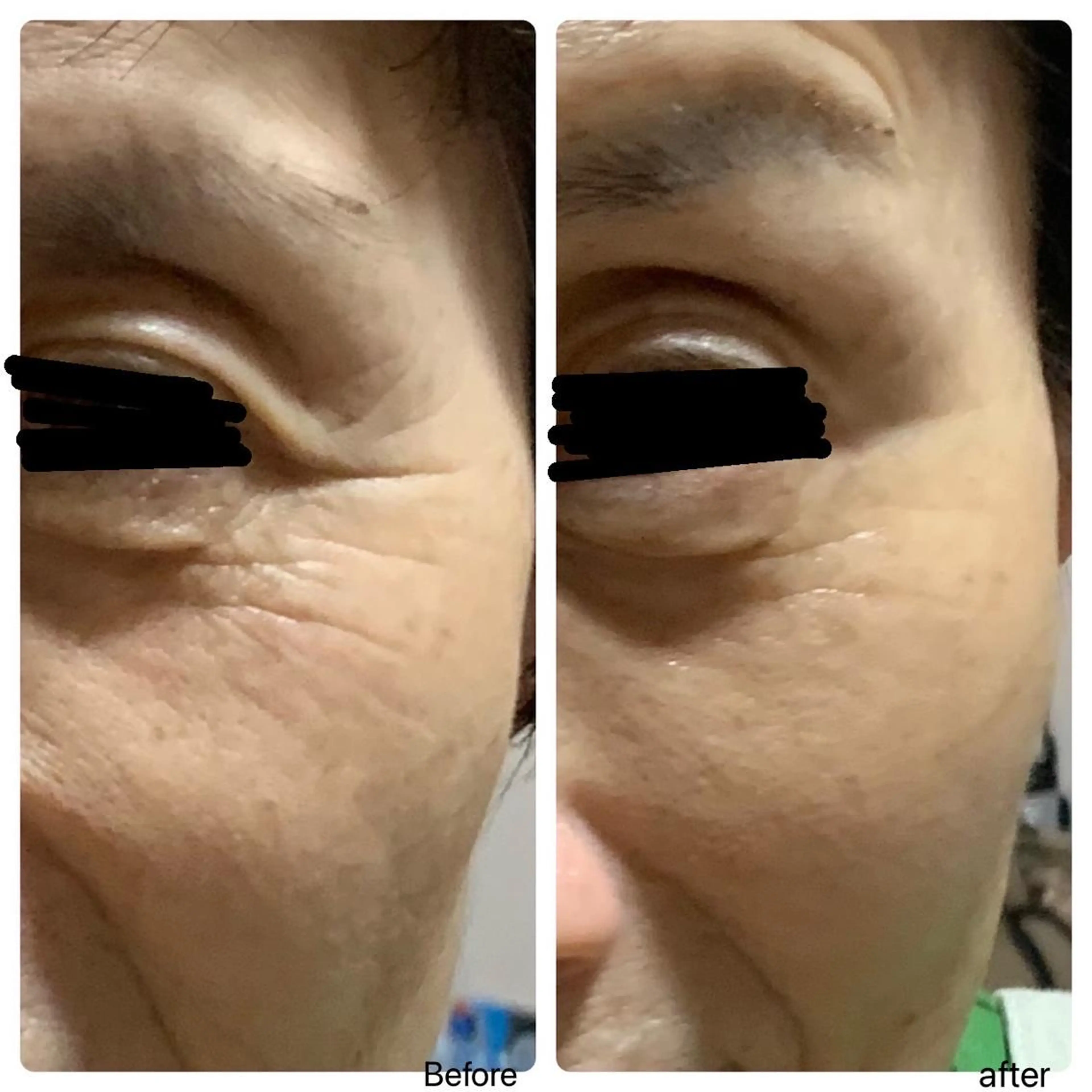 平日限定フェイシャル💆♀️の写真