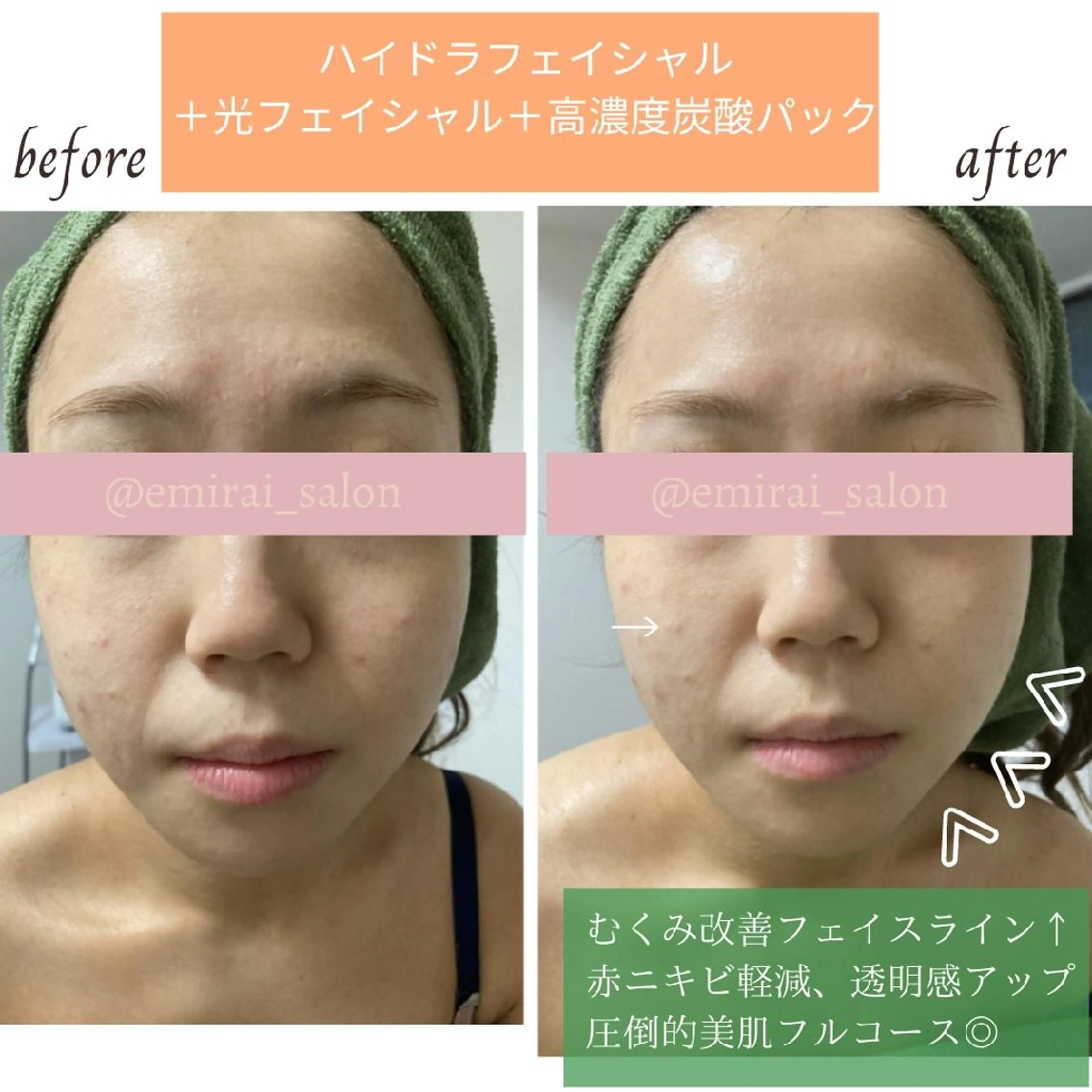 🌿emirai SEN🌿のエステ・リラクイメージ