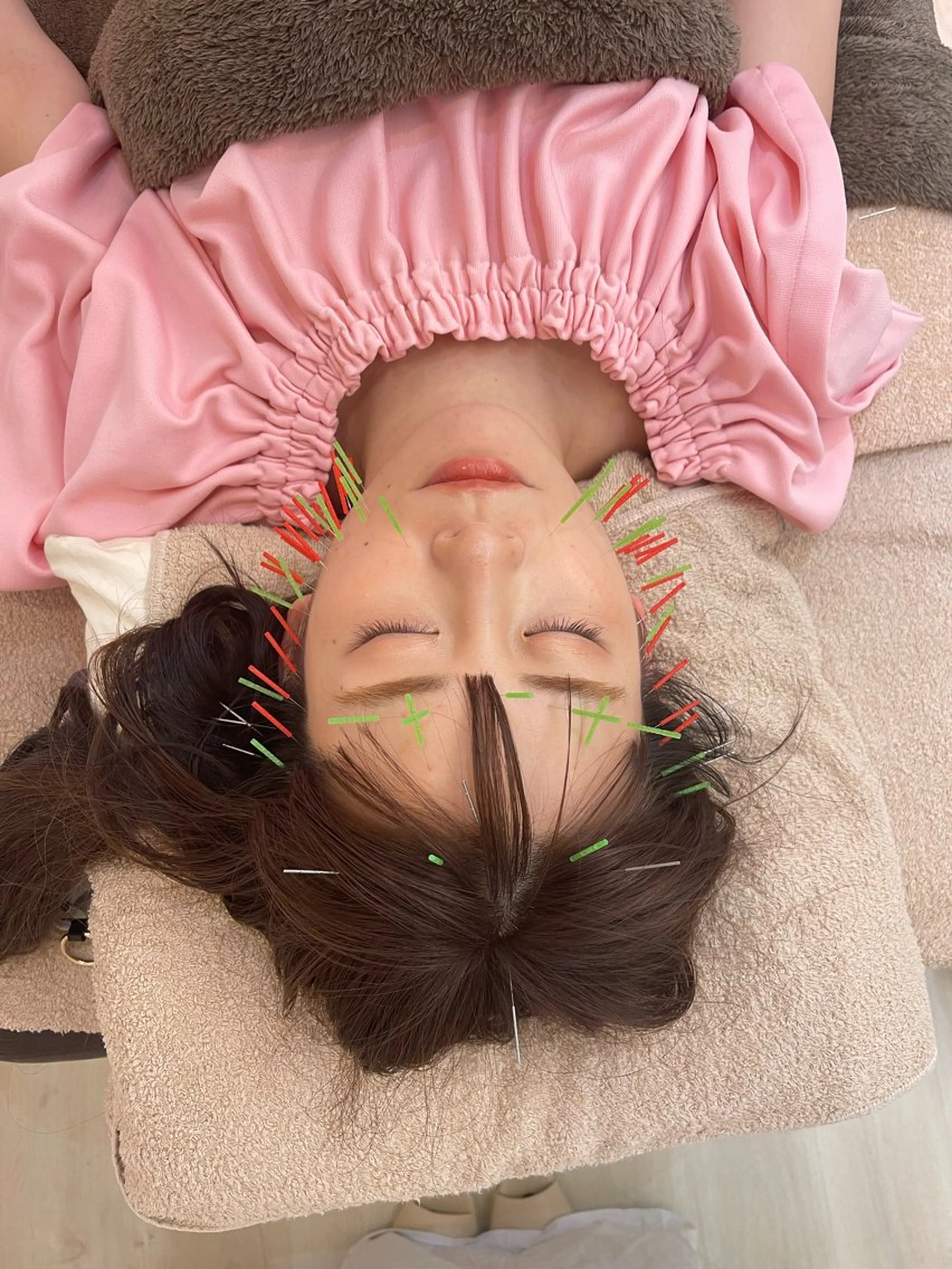 THE  ROOTS所属・美容鍼♡小顔矯正♡ fumikaのエステ・リラクイメージ