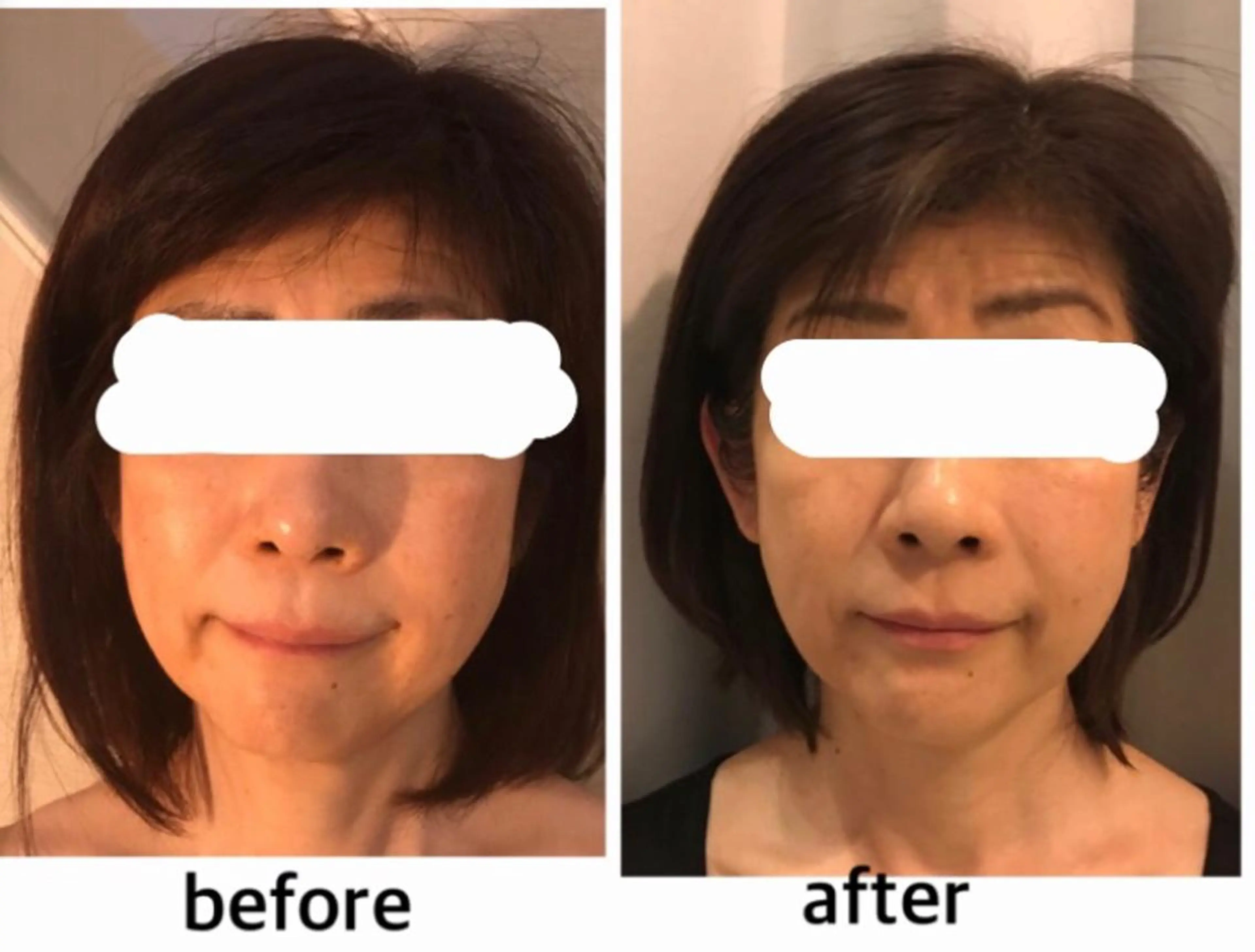 アクシア ビューティー サロン所属・究極のアンチエイ ジングサロンのエステ・リラクイメージ